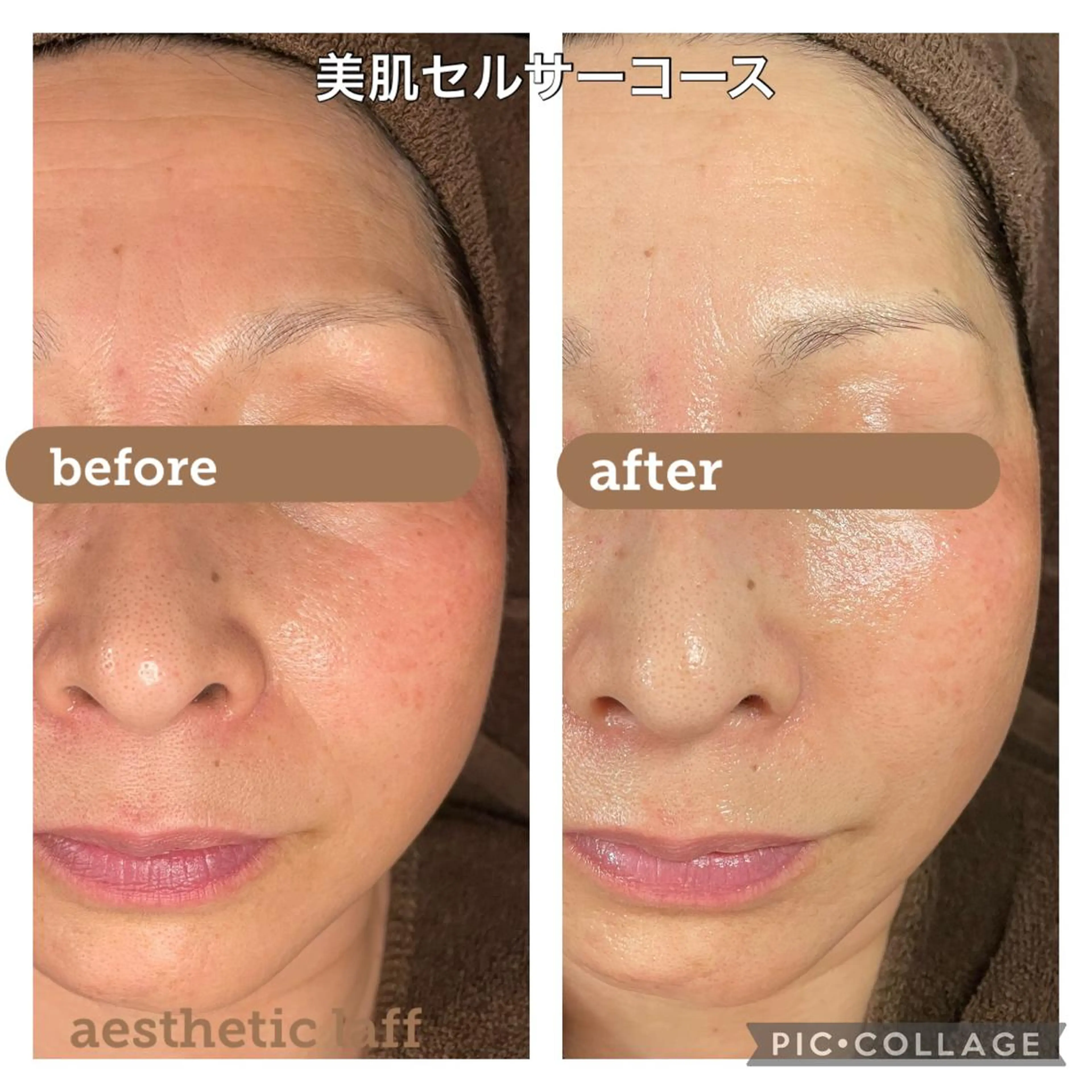 美肌作りのサロン 山村亜美のエステ・リラクイメージ