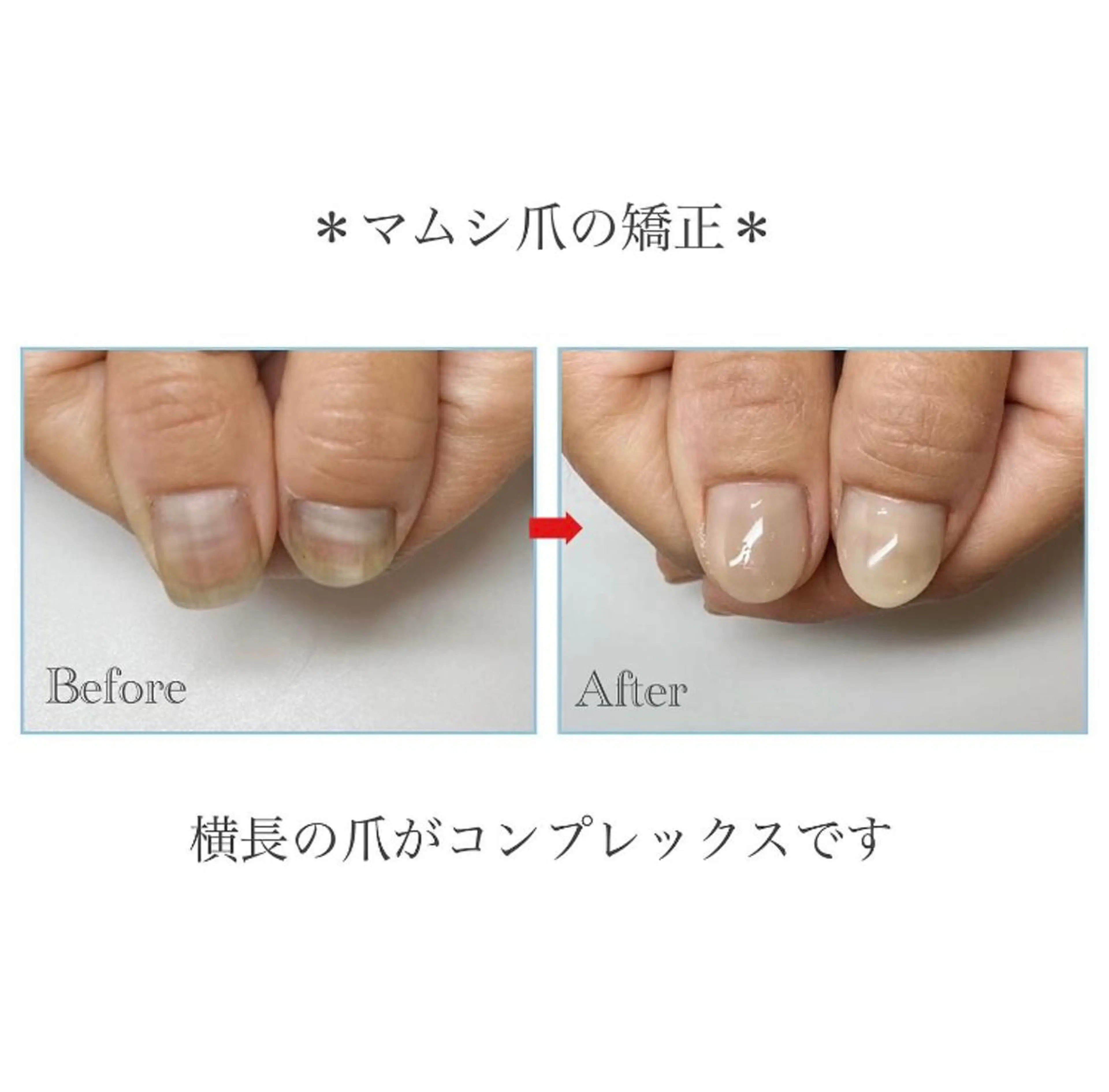 ネイル ネイルサロン アリュームのネイルデザイン