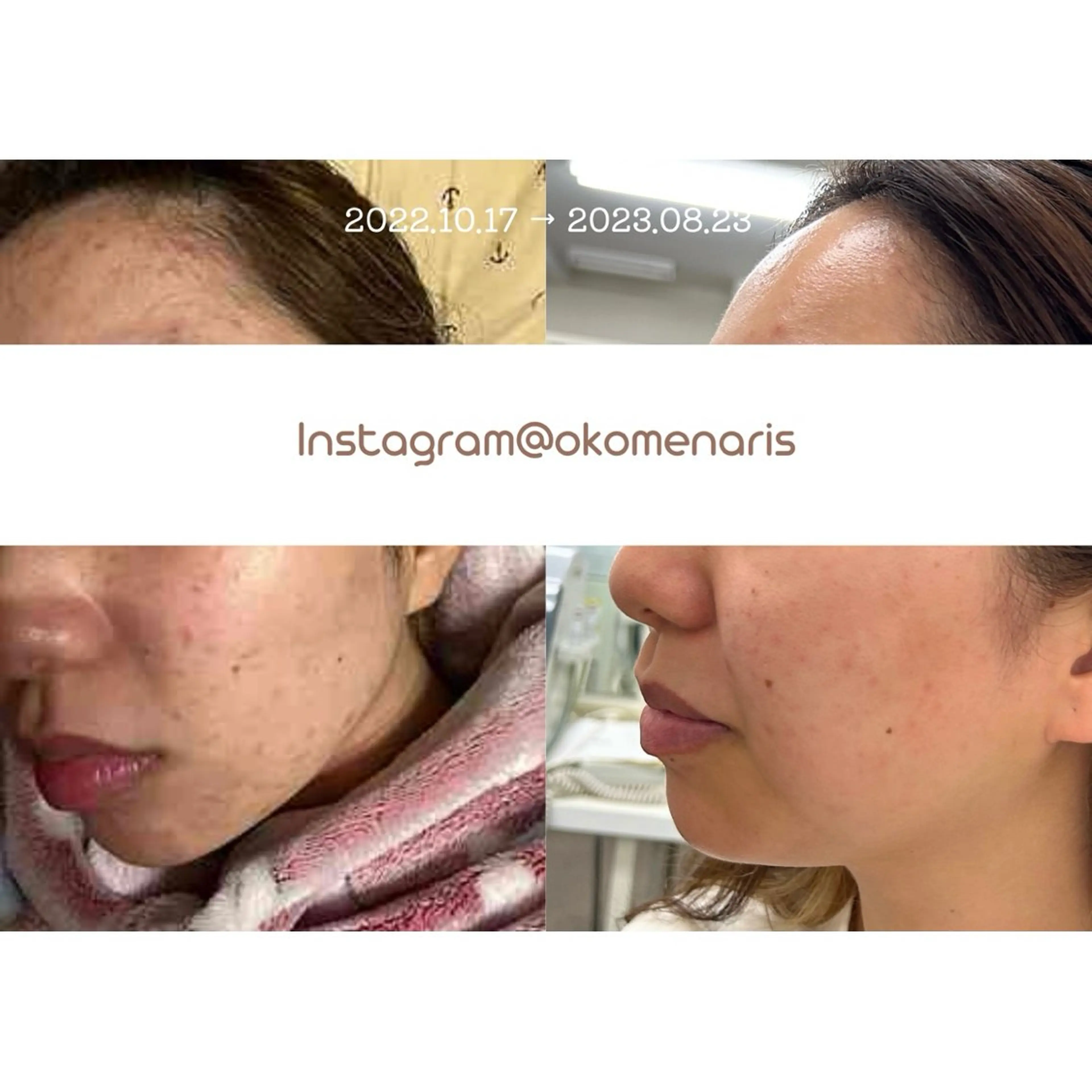 杉浦里沙⌇ 居心地いいエステのエステ・リラクイメージ