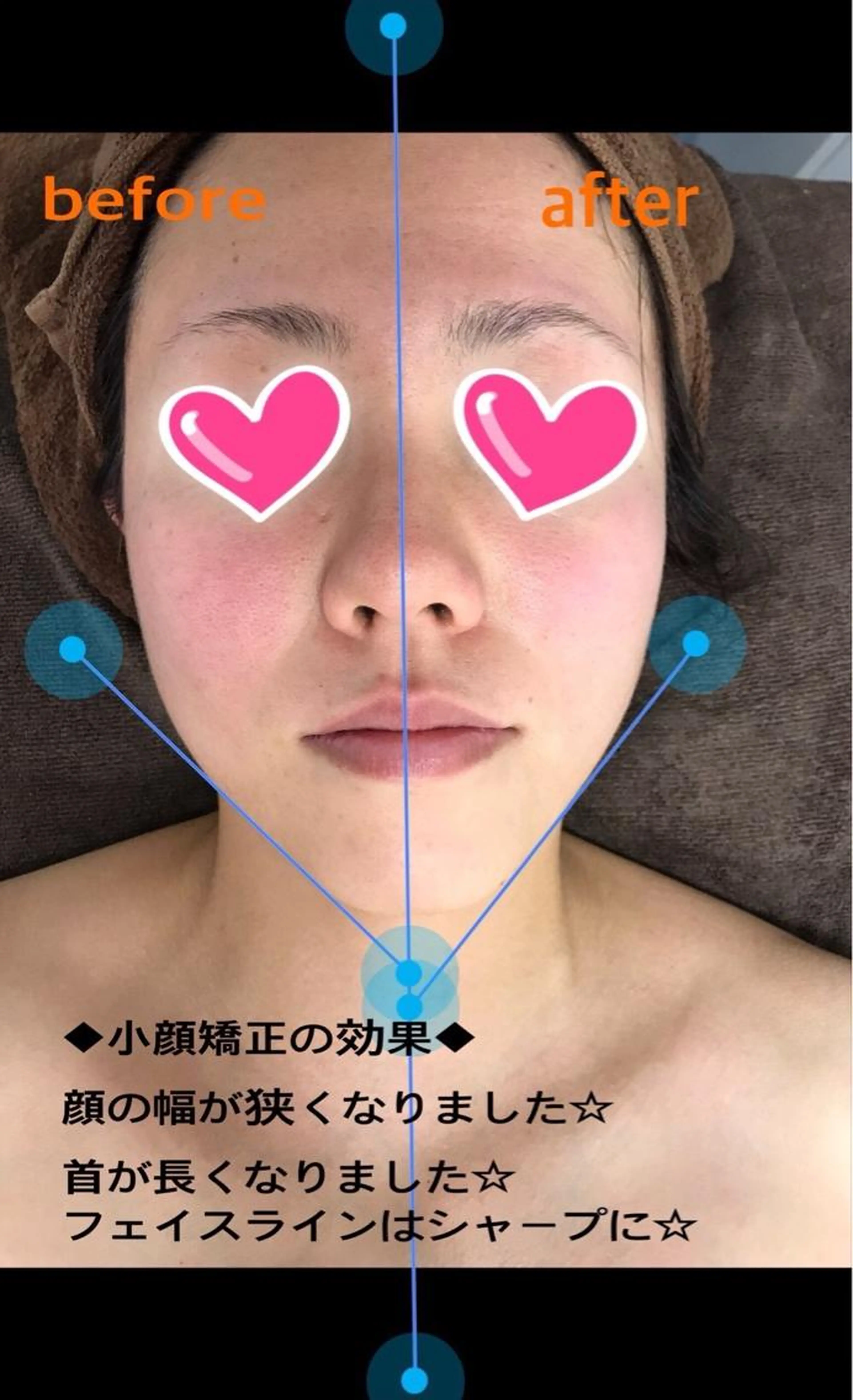 【小顔矯正】自慢の技術でスッキリとした骨格へ!30分8000円→5980円の写真