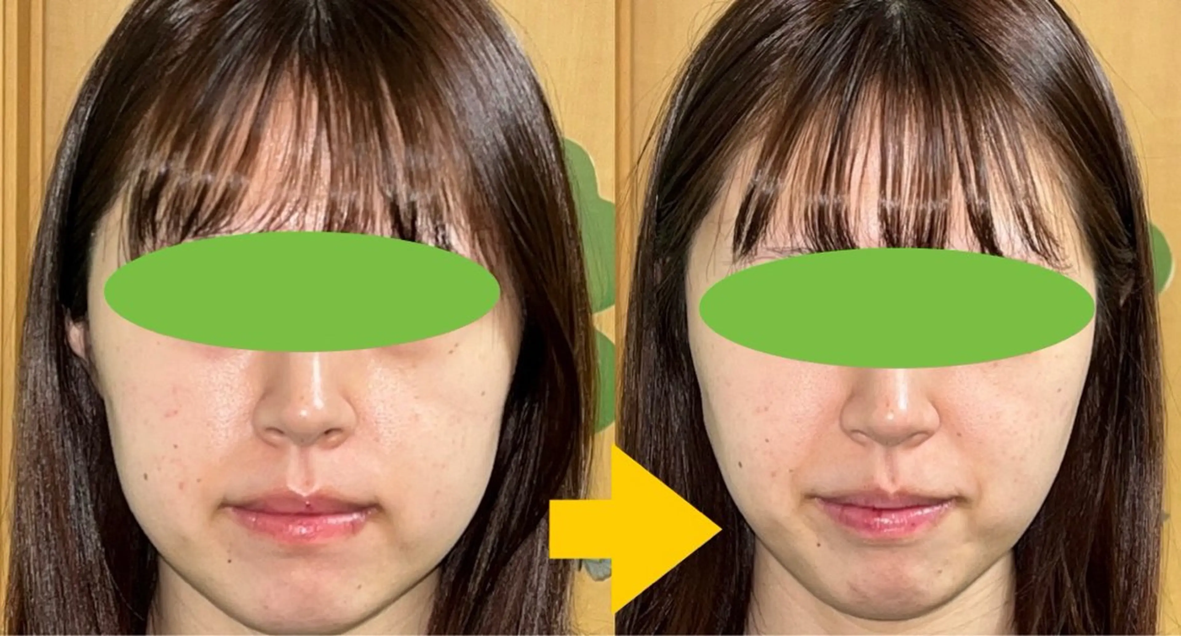 エステ リラク 春日井トータルからだ サロンふくふくのエステ・リラクイメージ