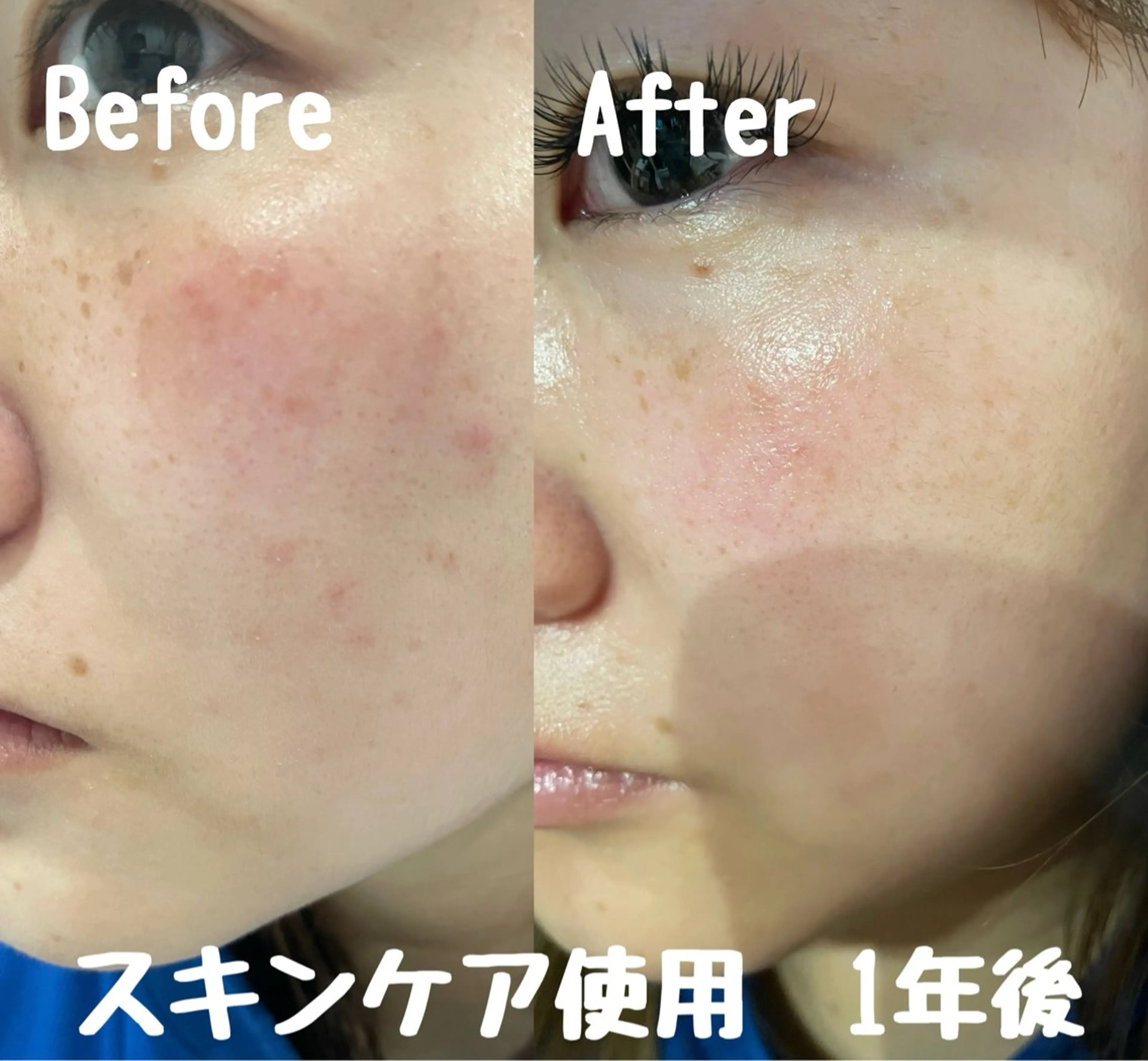 Surien 水脇ゆうのその他イメージ