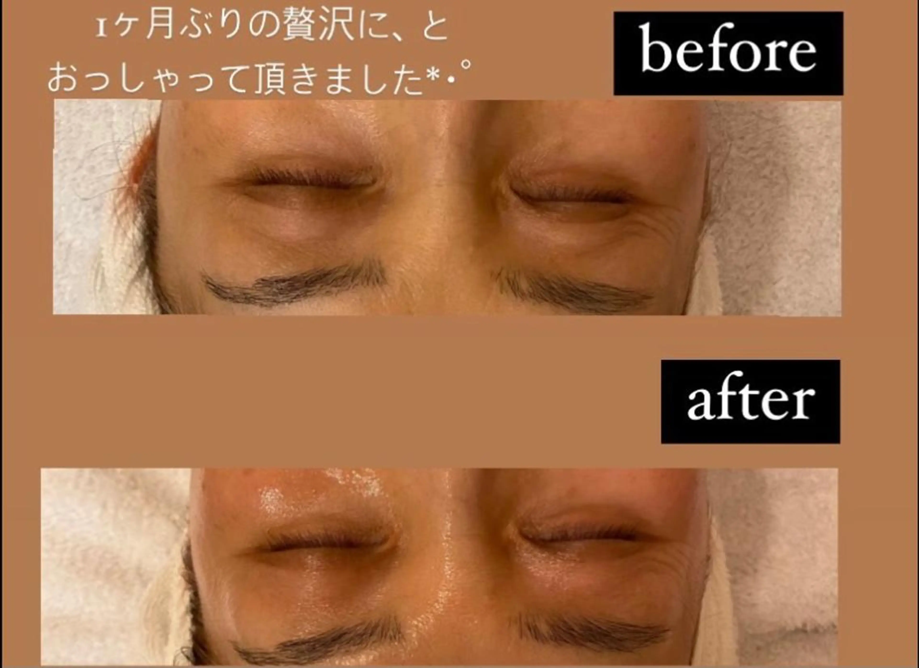 エステ リラク MENARD BLOOMのエステ・リラクイメージ