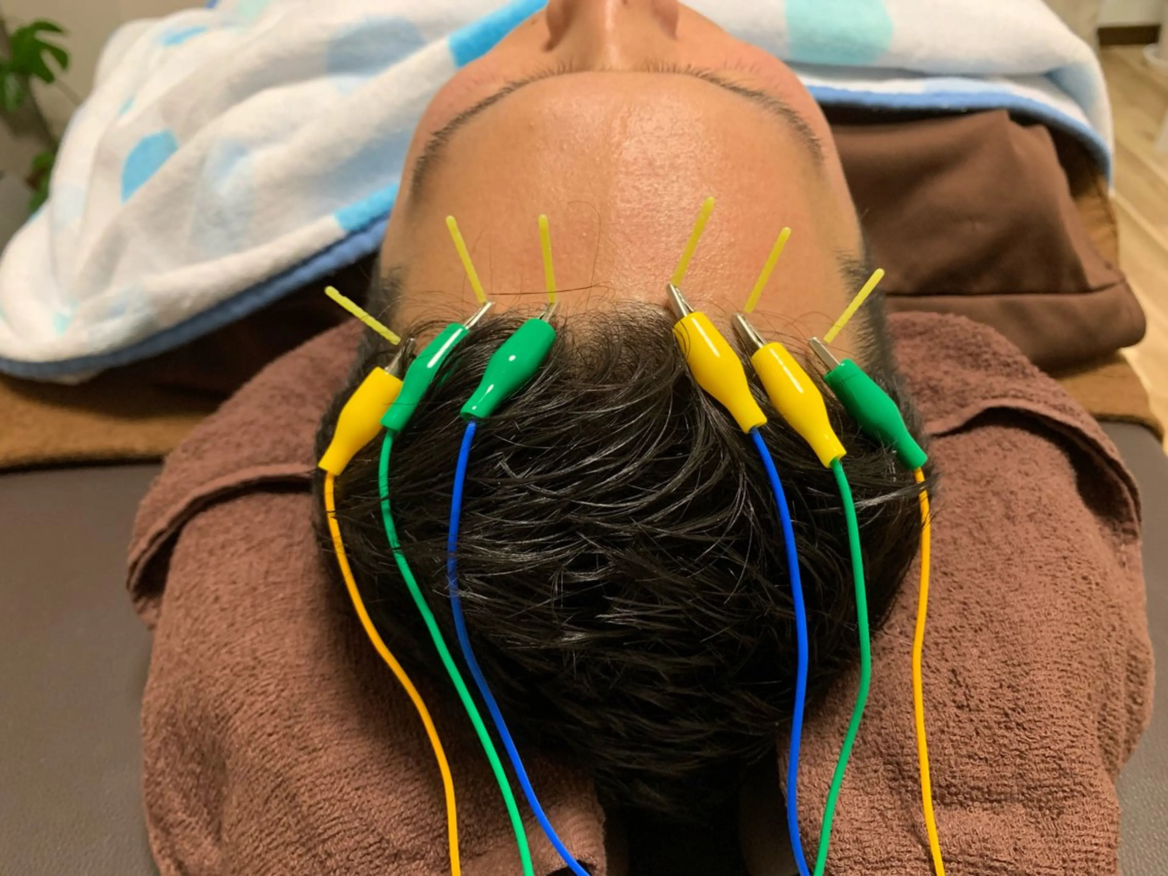 【ストレス限界の方へ】頭と首から整えるリラックスの写真