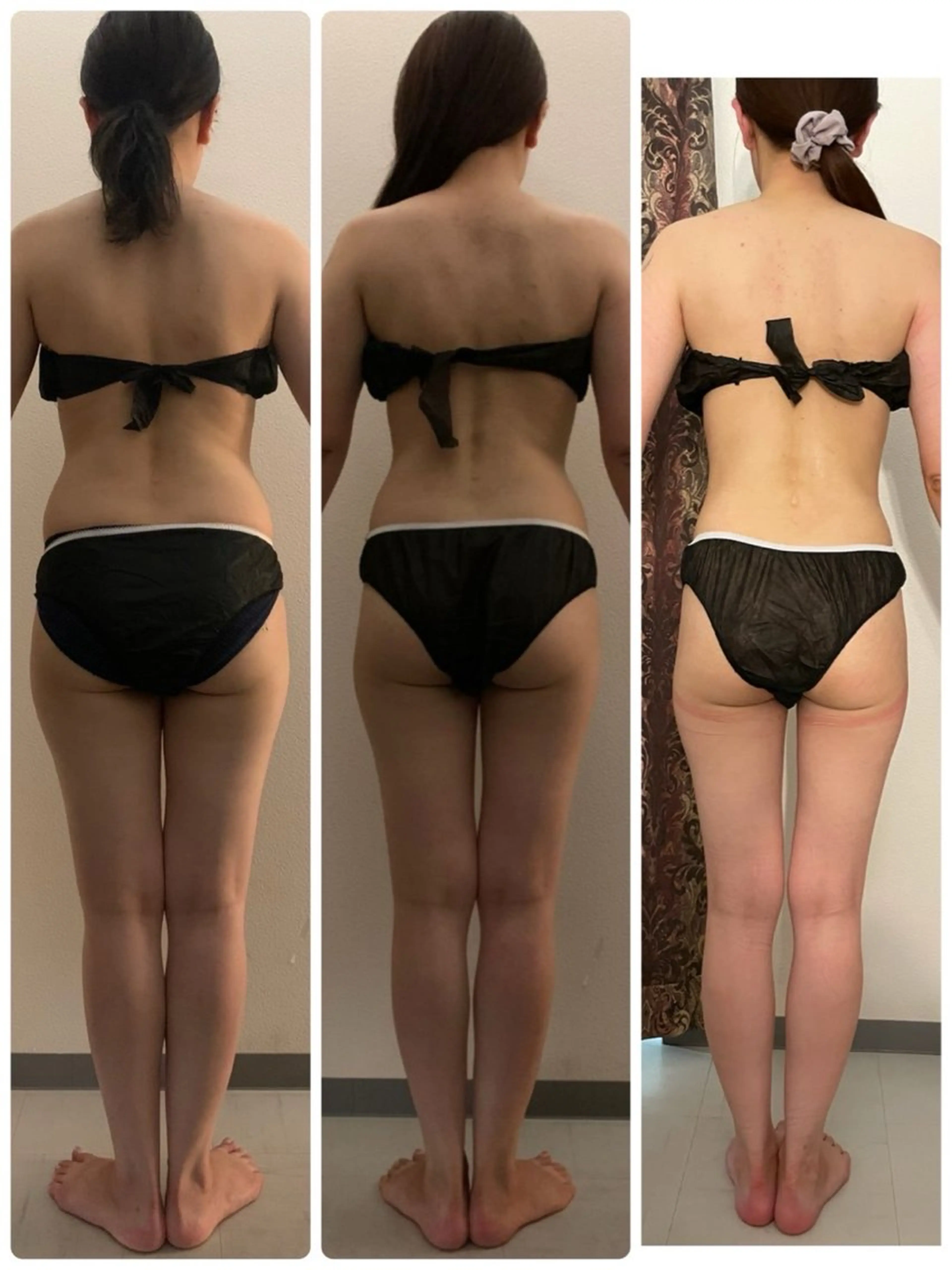 高速脱毛エステ リアンのエステ・リラクイメージ