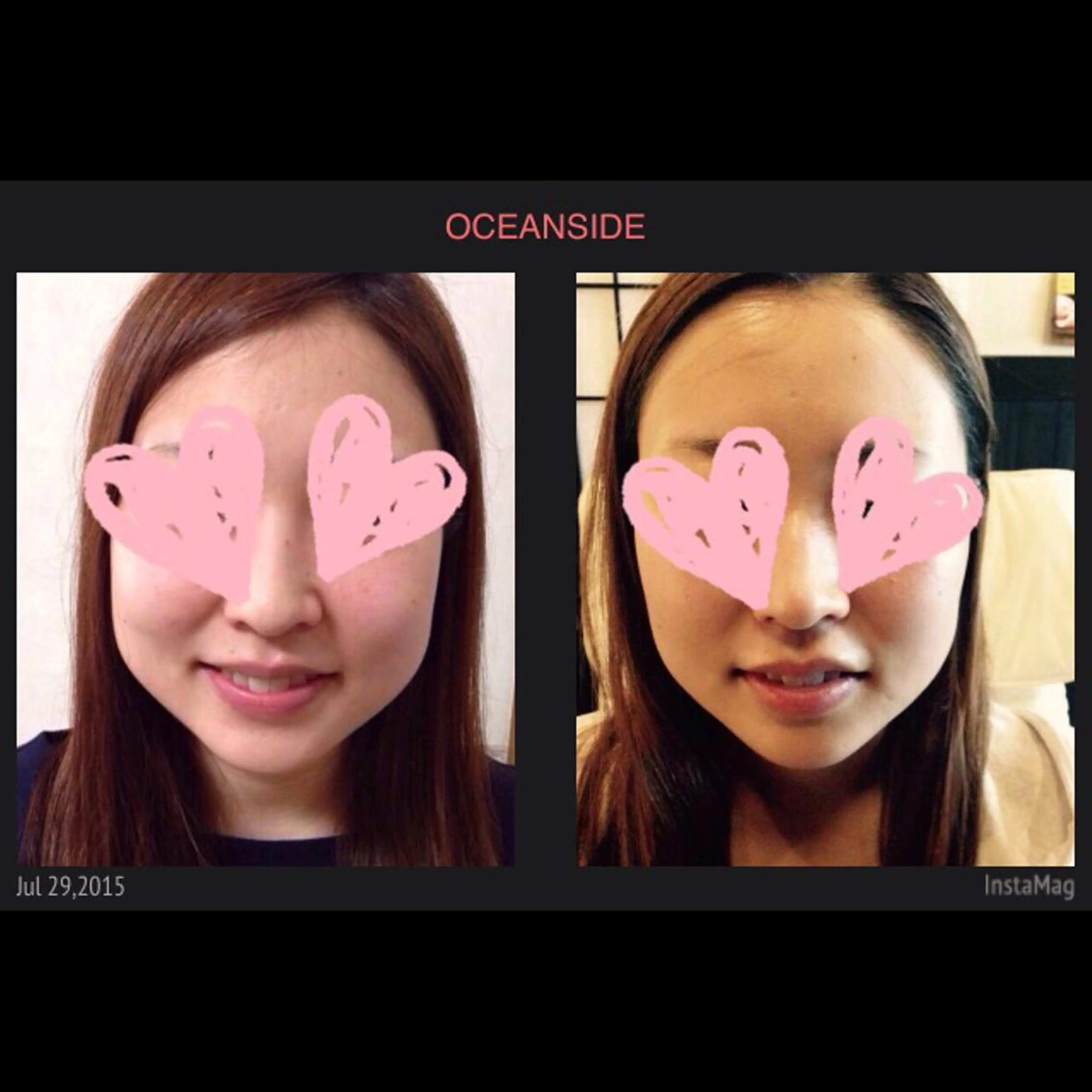 小顔最強セット✨5000円❗️驚愕の即効性や瞬間小顔❗️お試しください❤️の写真