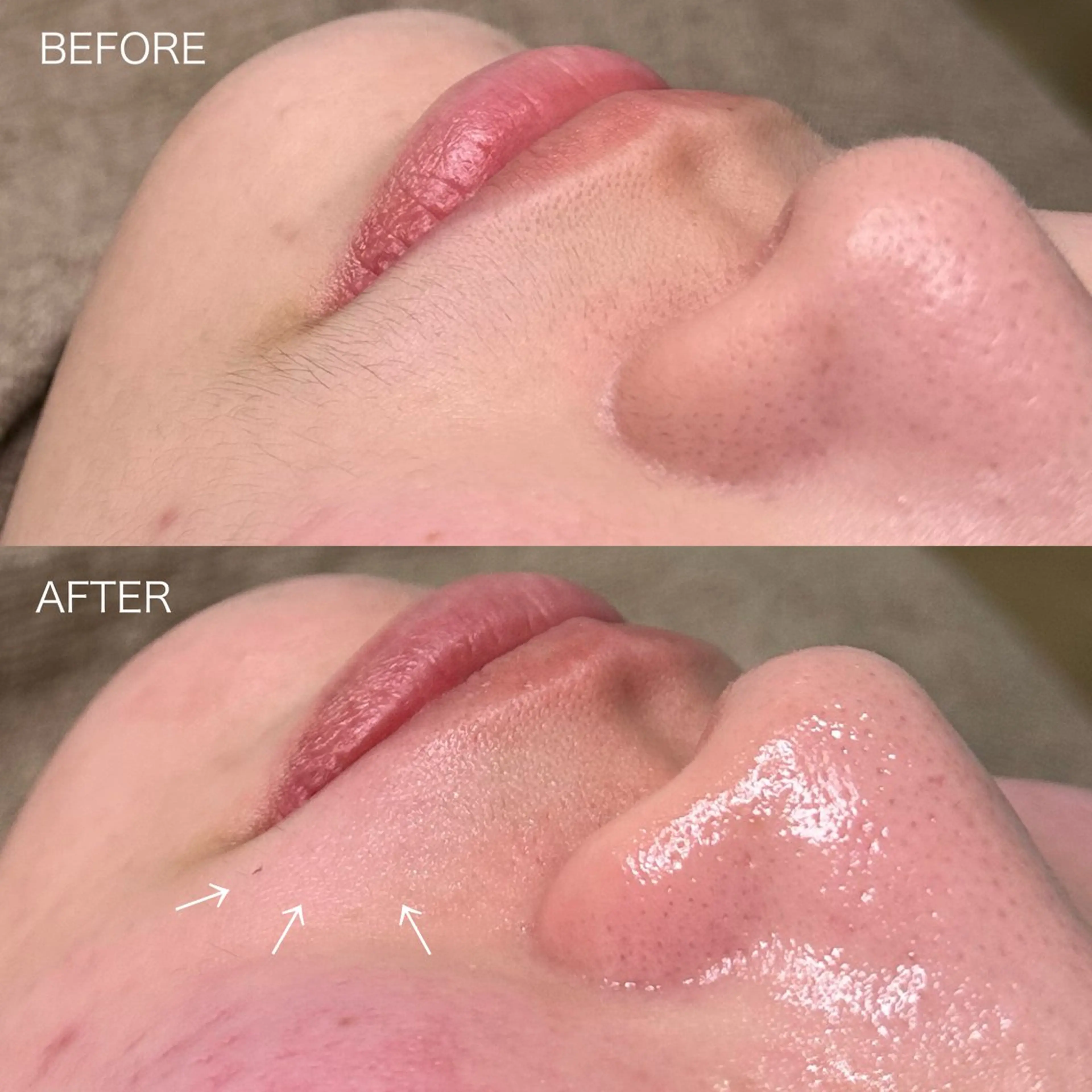 脱毛 HBLaward受賞 KANAの眉毛・アイブロウイメージ