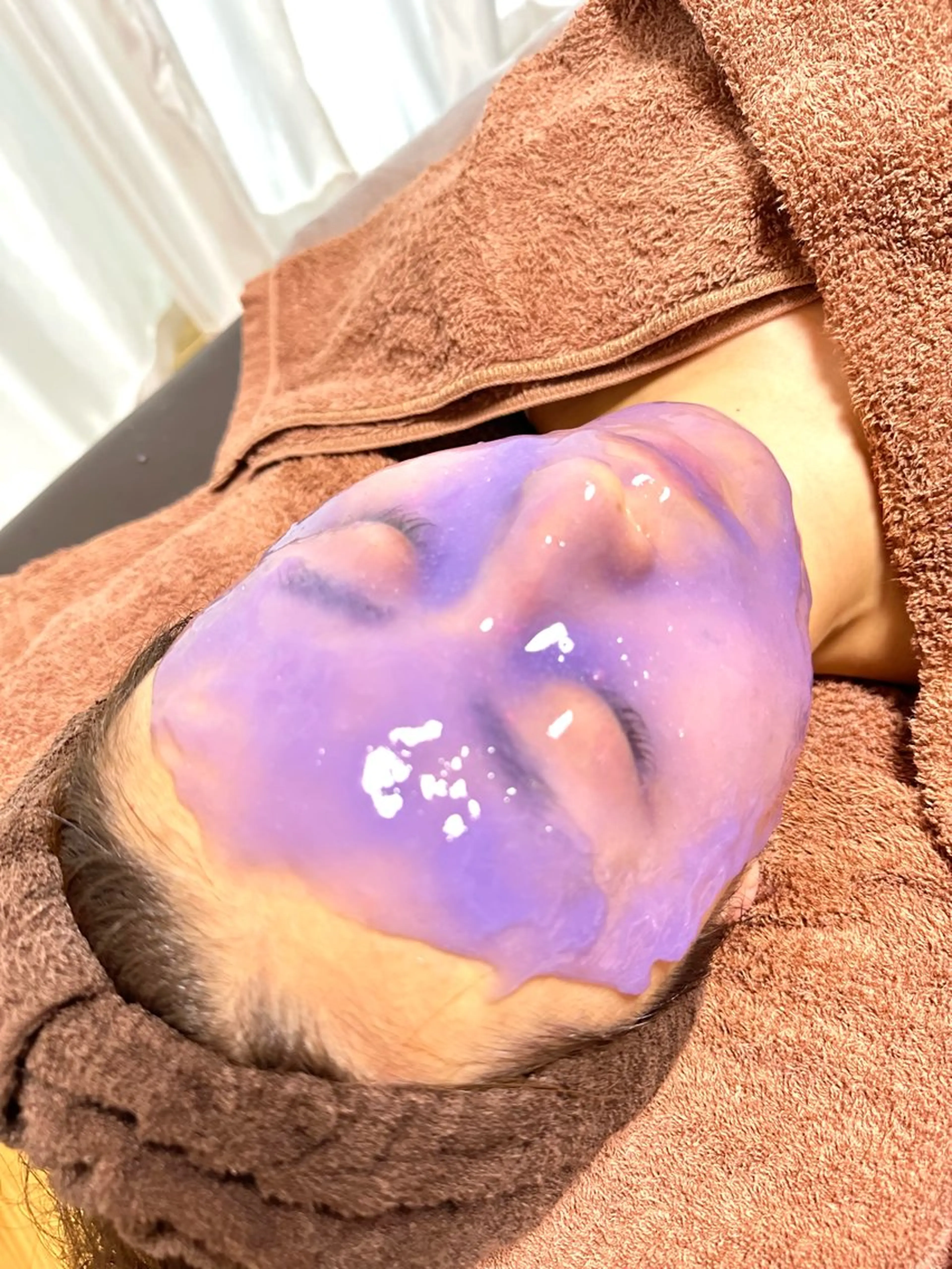 全身脱毛(顔・VIO込)＋ハイドロジェリーマスク¥15,000の写真