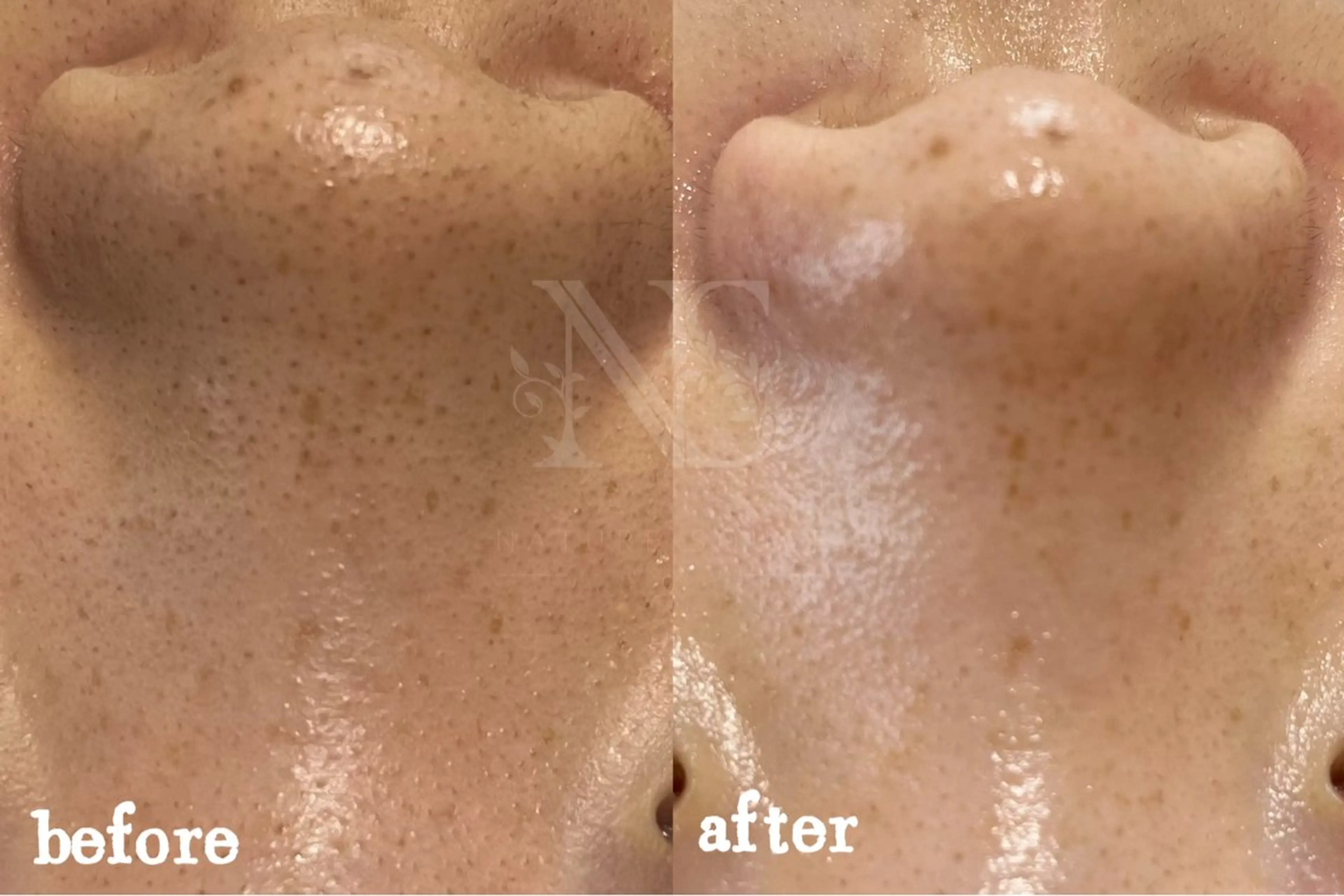 Nature Souce毛穴専門店のその他イメージ