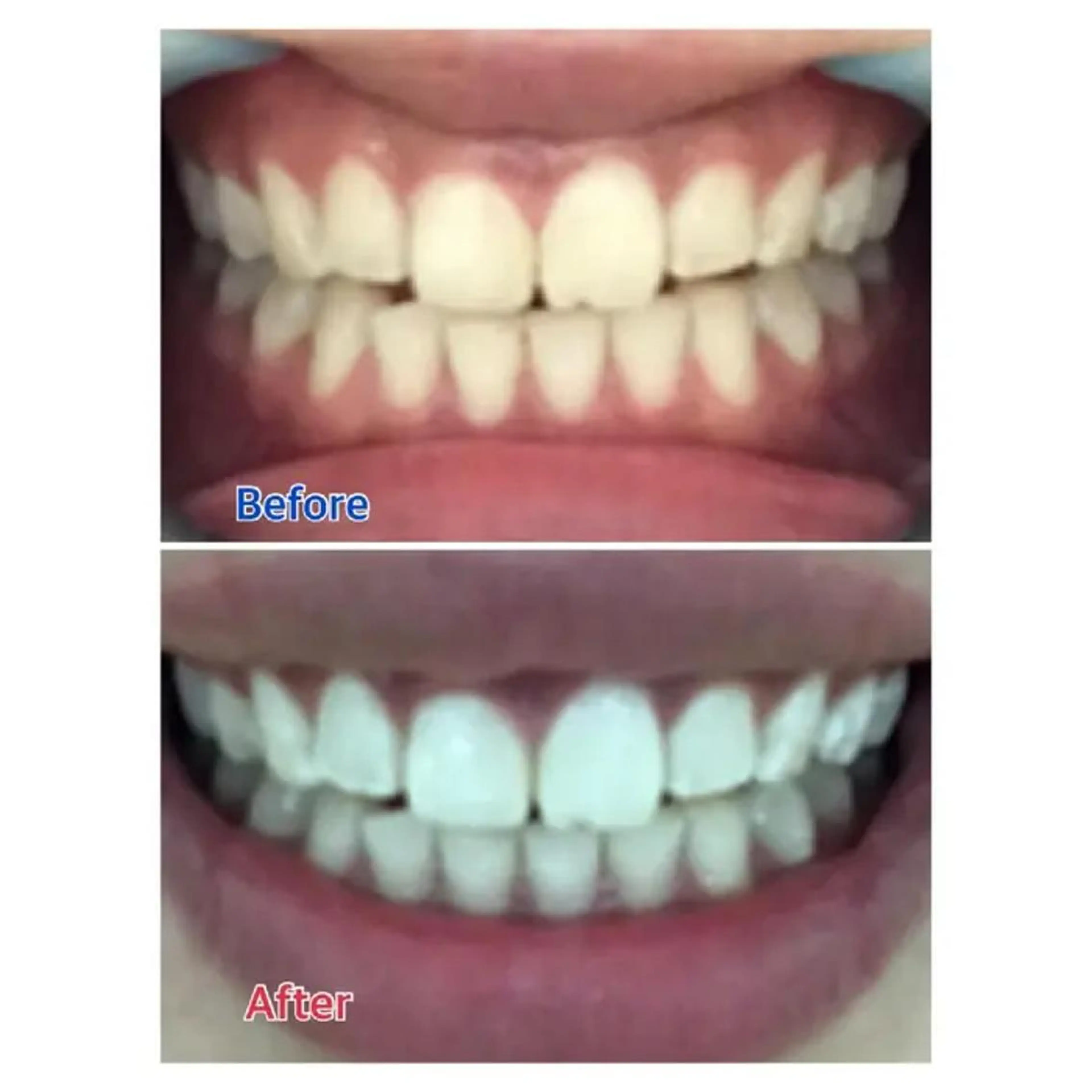 M渋谷 ホワイトニングのその他イメージ