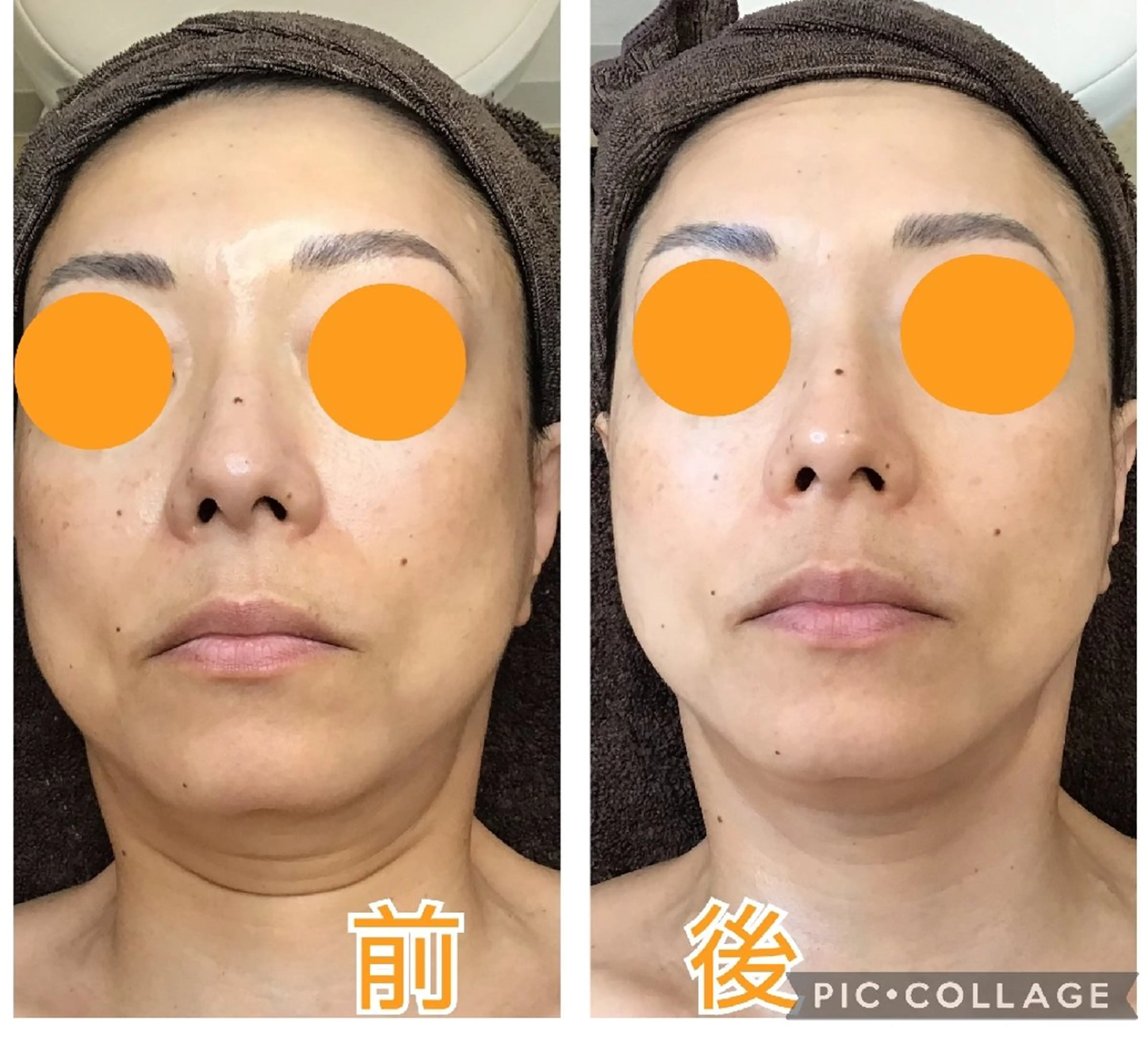 エステ MAXまつ毛&  フェイシャルのマツエク・マツパデザイン