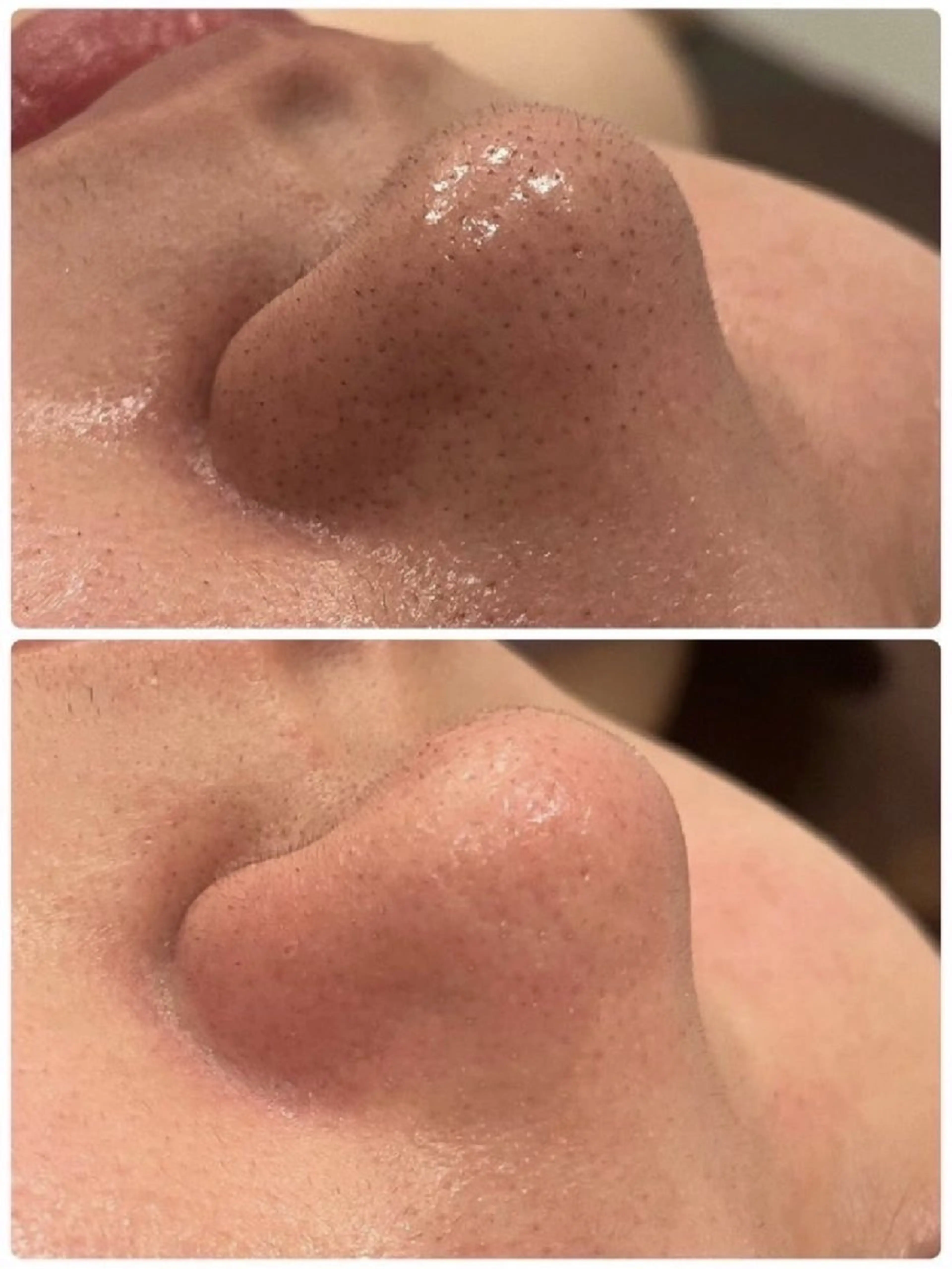 エステ Abe Yukaのエステ・リラクイメージ