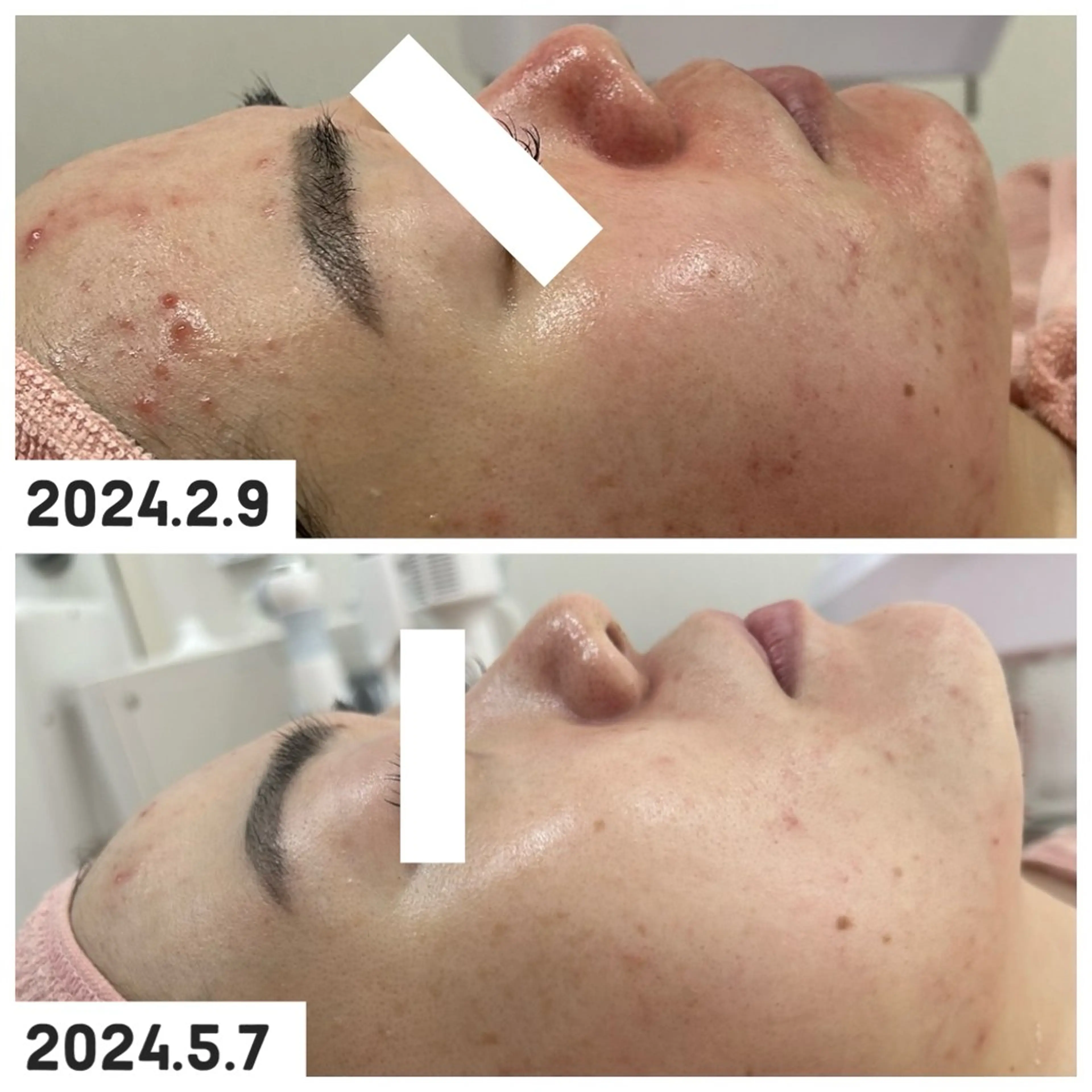 エステ 【現役看護師】高来 笑子のエステ・リラクイメージ