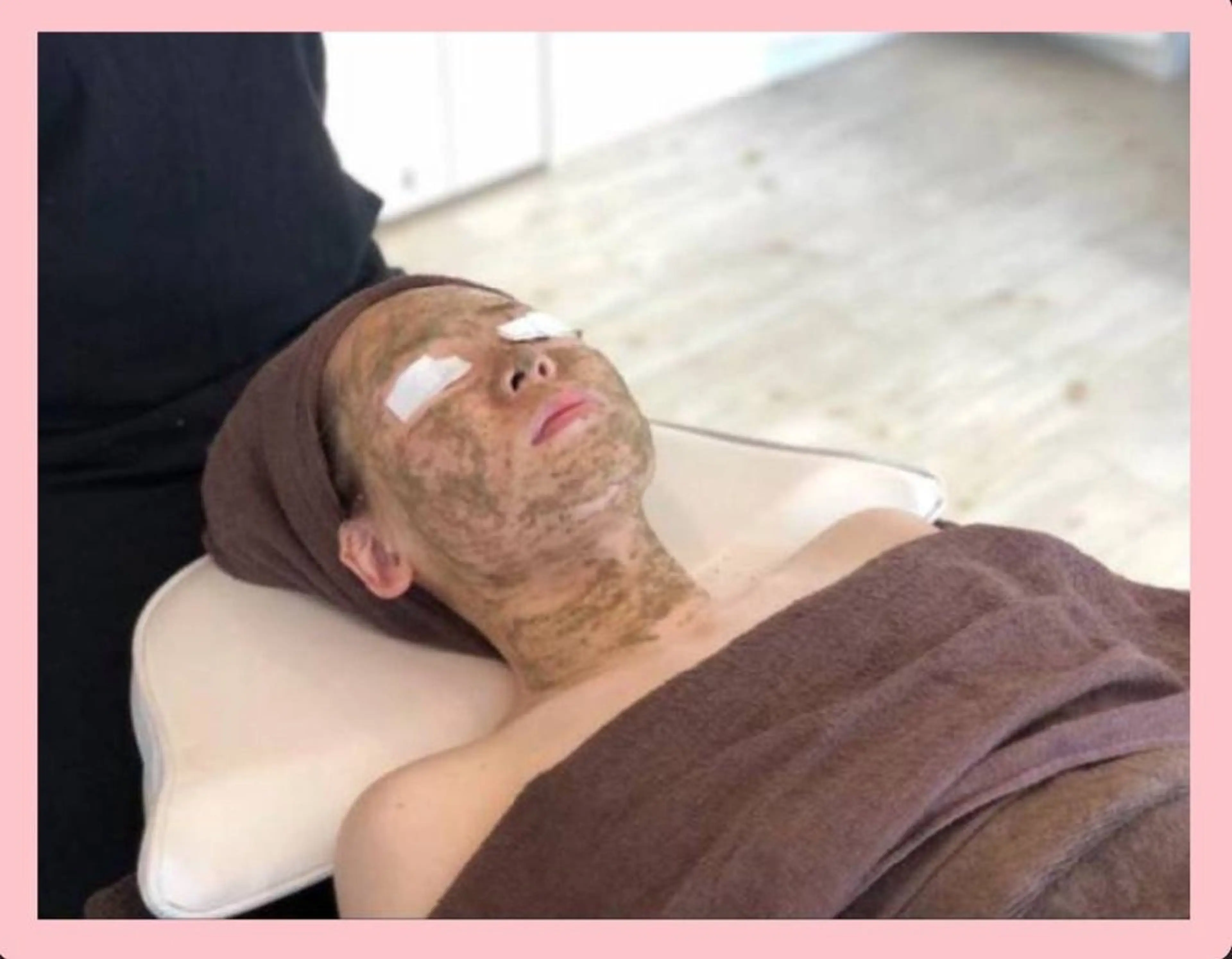 平日限定‼️フェイスハーブピーリングソフト(剥離あり)🌿ニキビ、クレーター、毛穴、肌質改善🩷土、日、祭日は8800円の写真