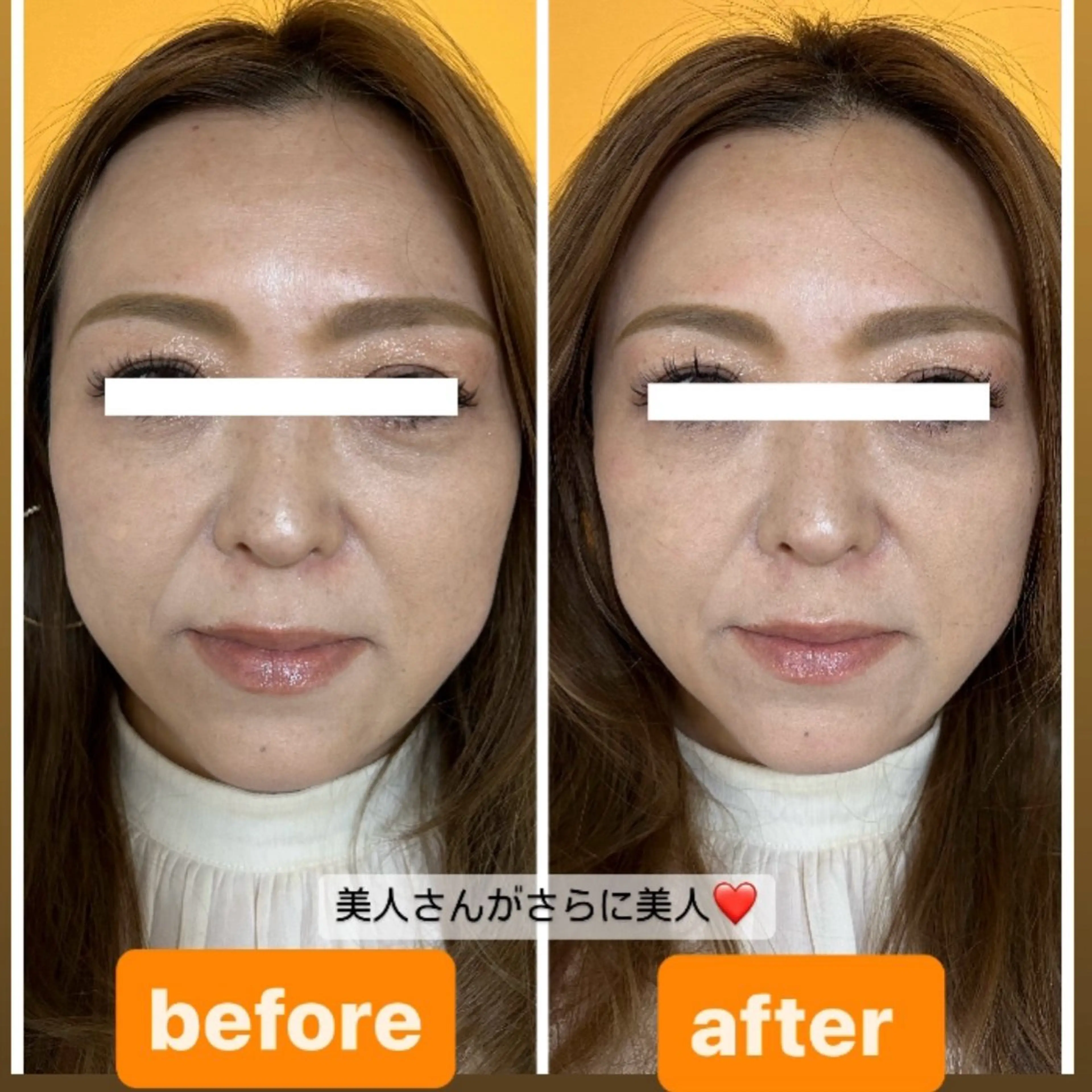 ロング 小顔カット エステ カイロプラクティックアンズ所属・カイロプラクティック アンズ（営業電話✖️のエステ・リラクイメージ