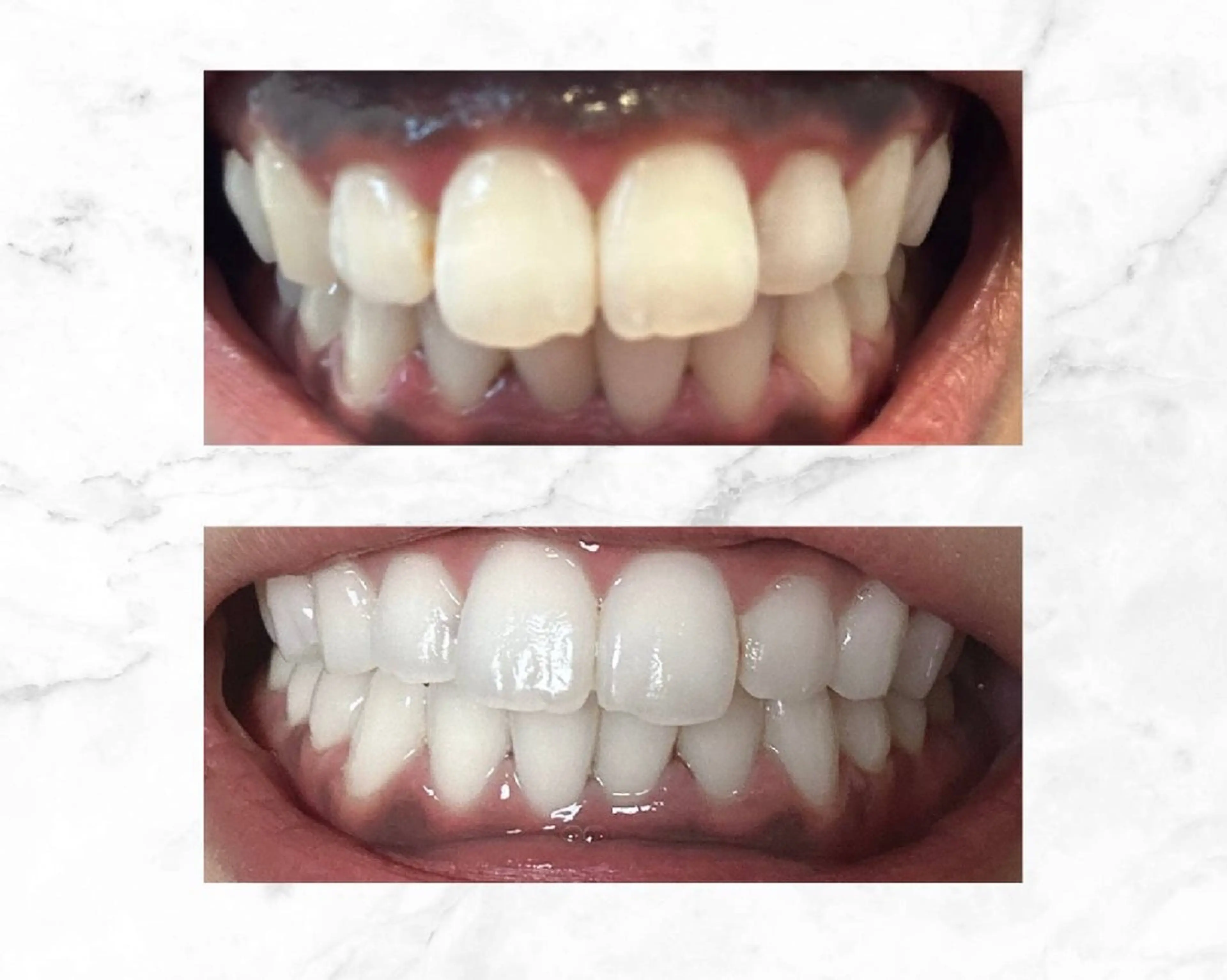 セルフホワイトニングビューティー三川店所属・中村 江梨香のその他イメージ