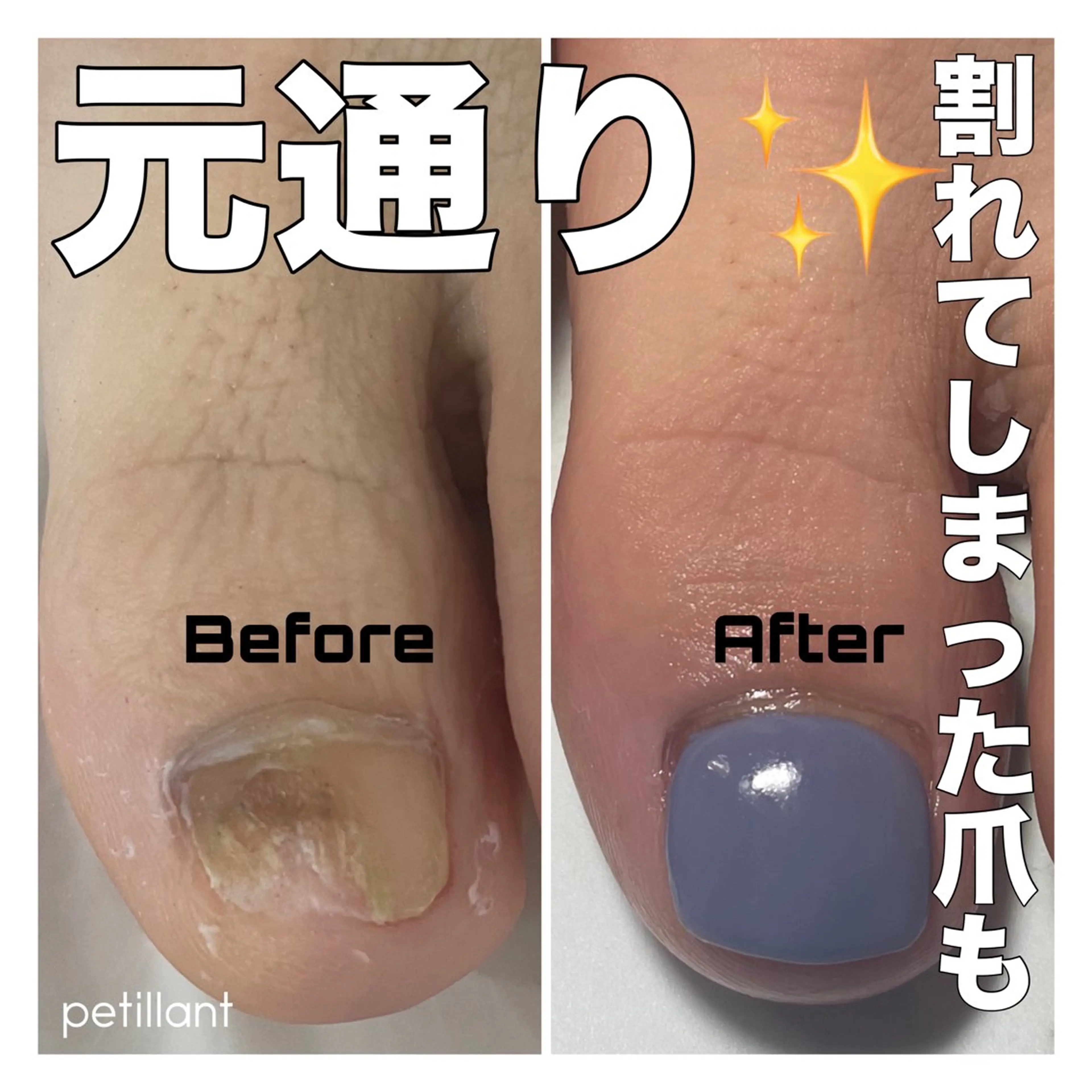 ネイル フットネイル nail salon petillantのネイルデザイン