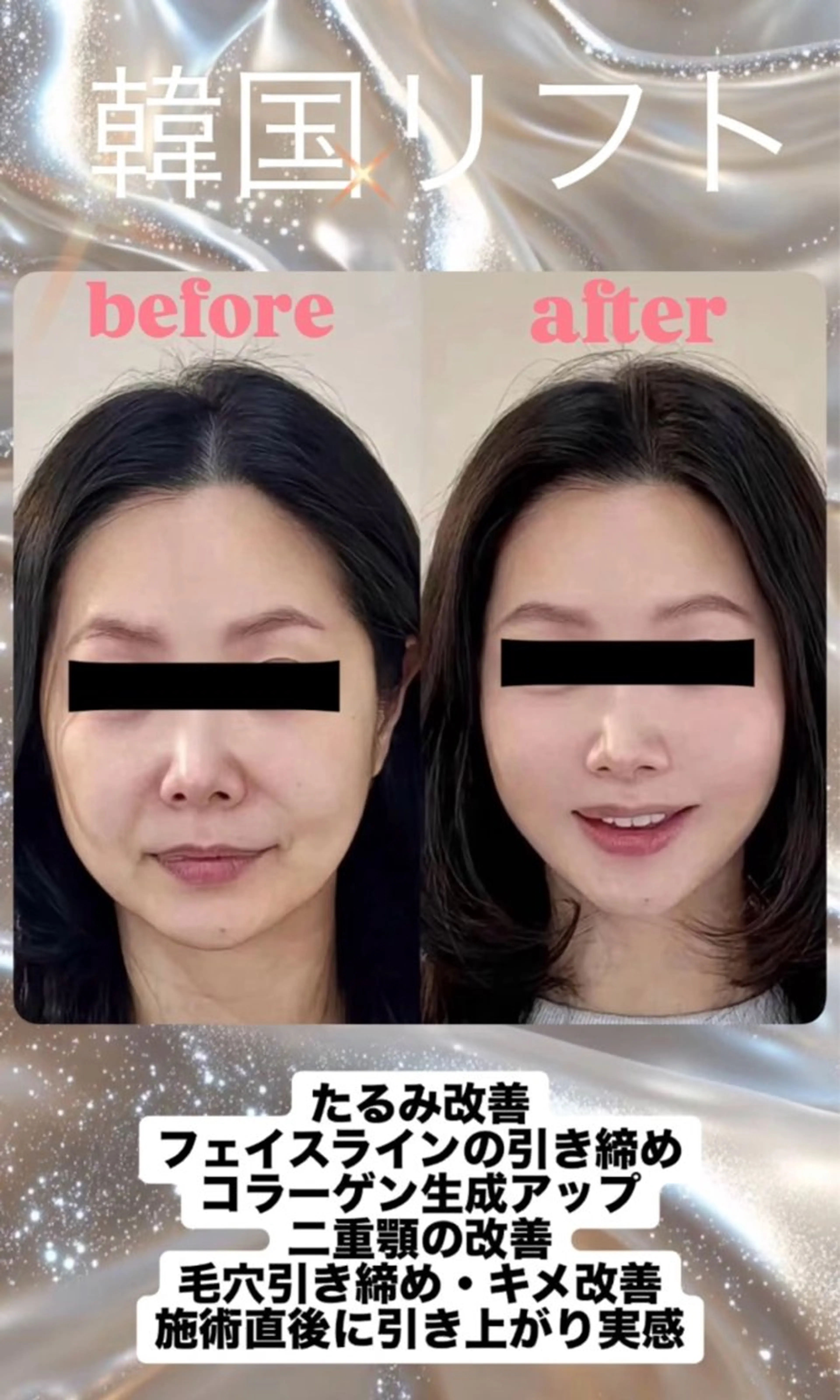 マツエク・マツパ エステ リラク 愛維美水光美肌専門店 メンズレディースokのエステ・リラクイメージ