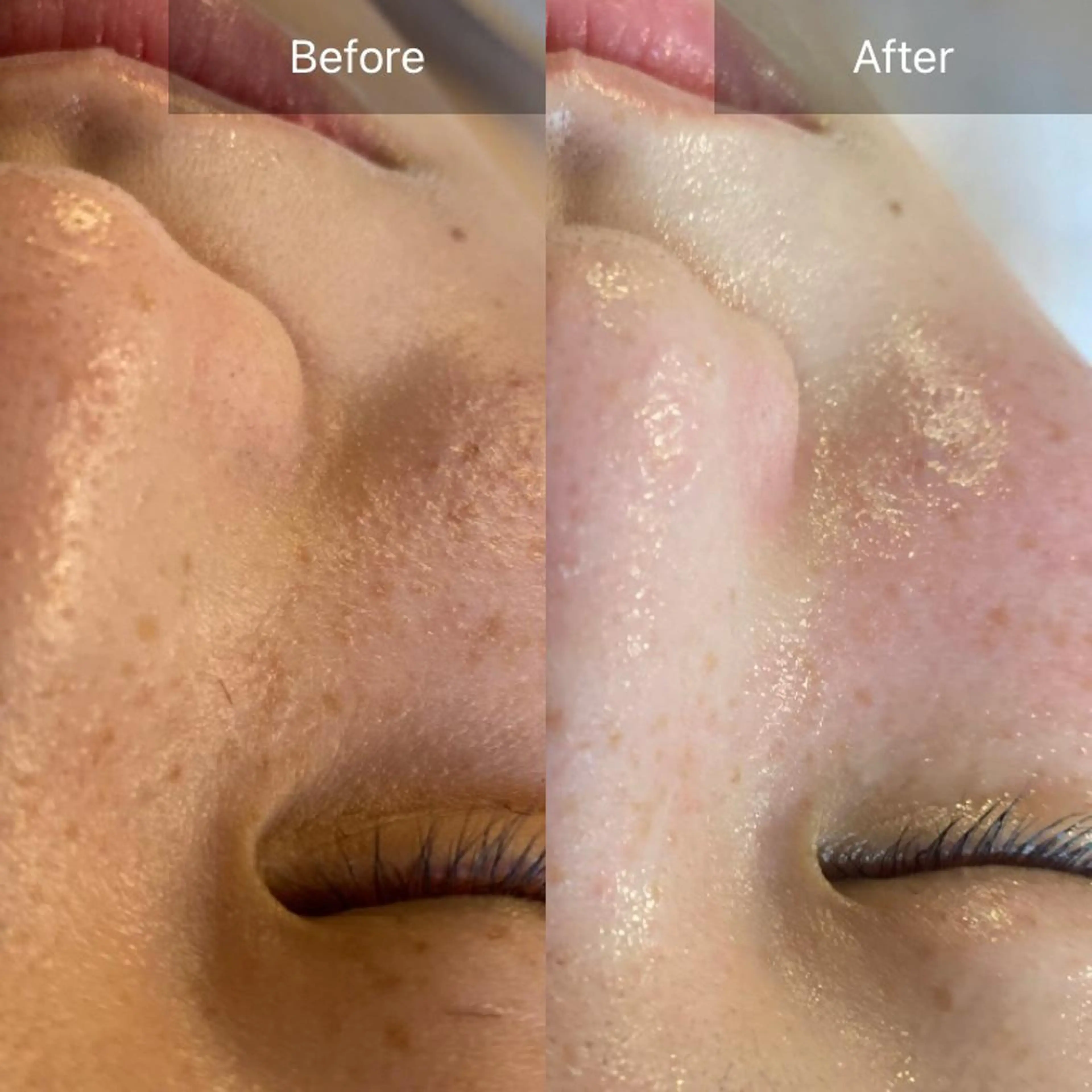 Mandarin Orange所属・毛穴から始める肌メン テマンダリンオレンジのエステ・リラクイメージ