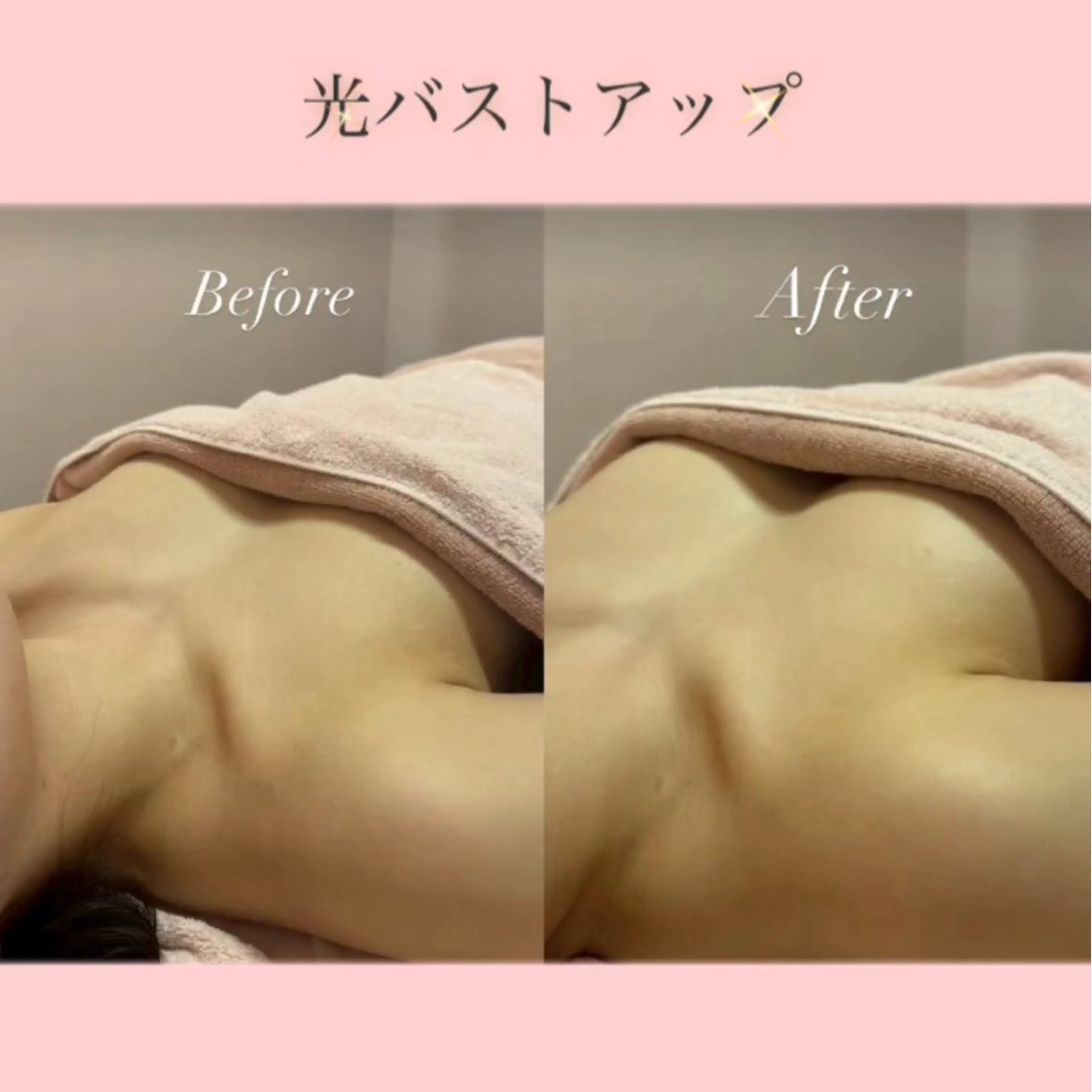 ✨🫧【4月限定】ボリュームUP &ぷるふわバストアップ👙🪄✨の写真