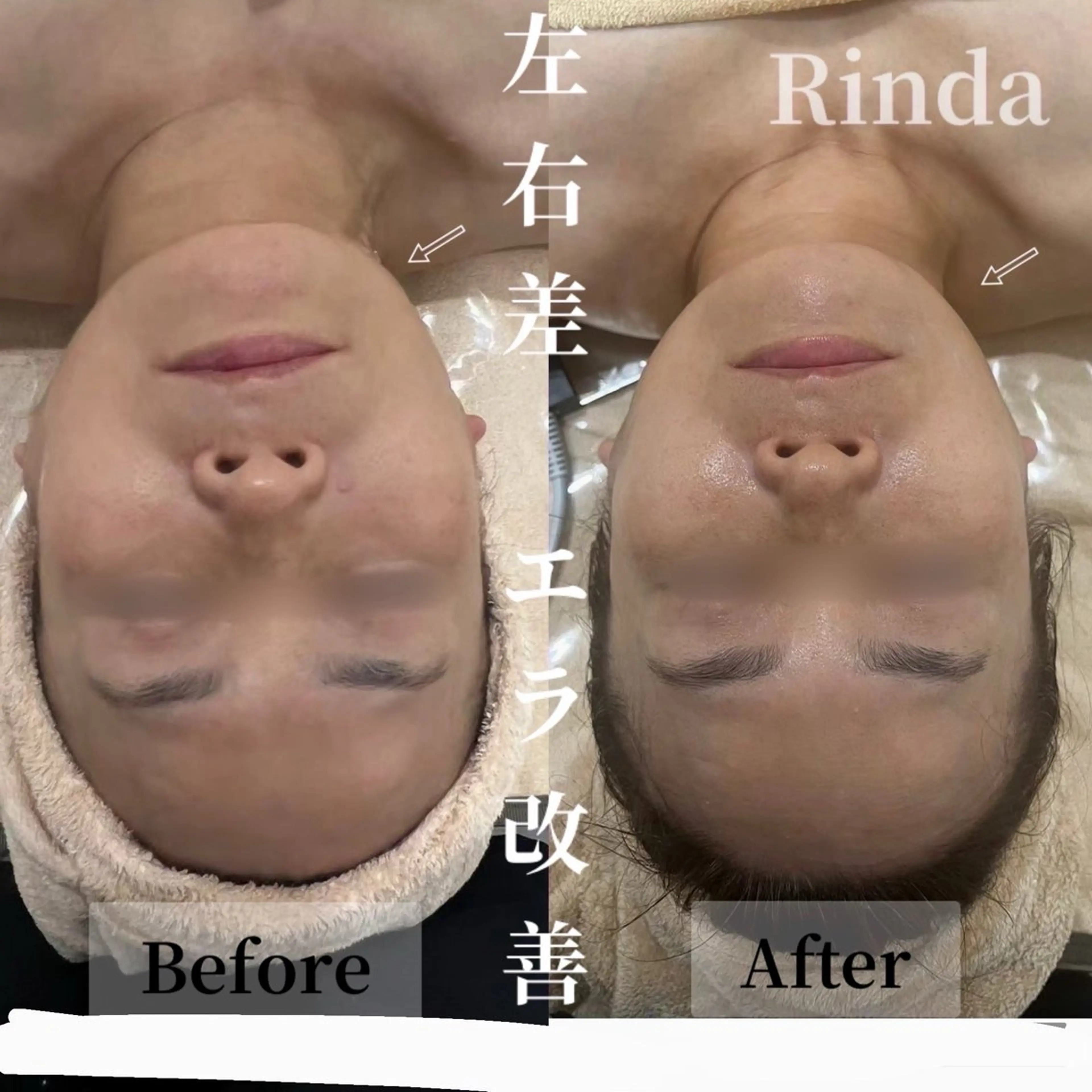 ブライダル痩身×脱毛 尼崎駅前サロンのエステ・リラクイメージ