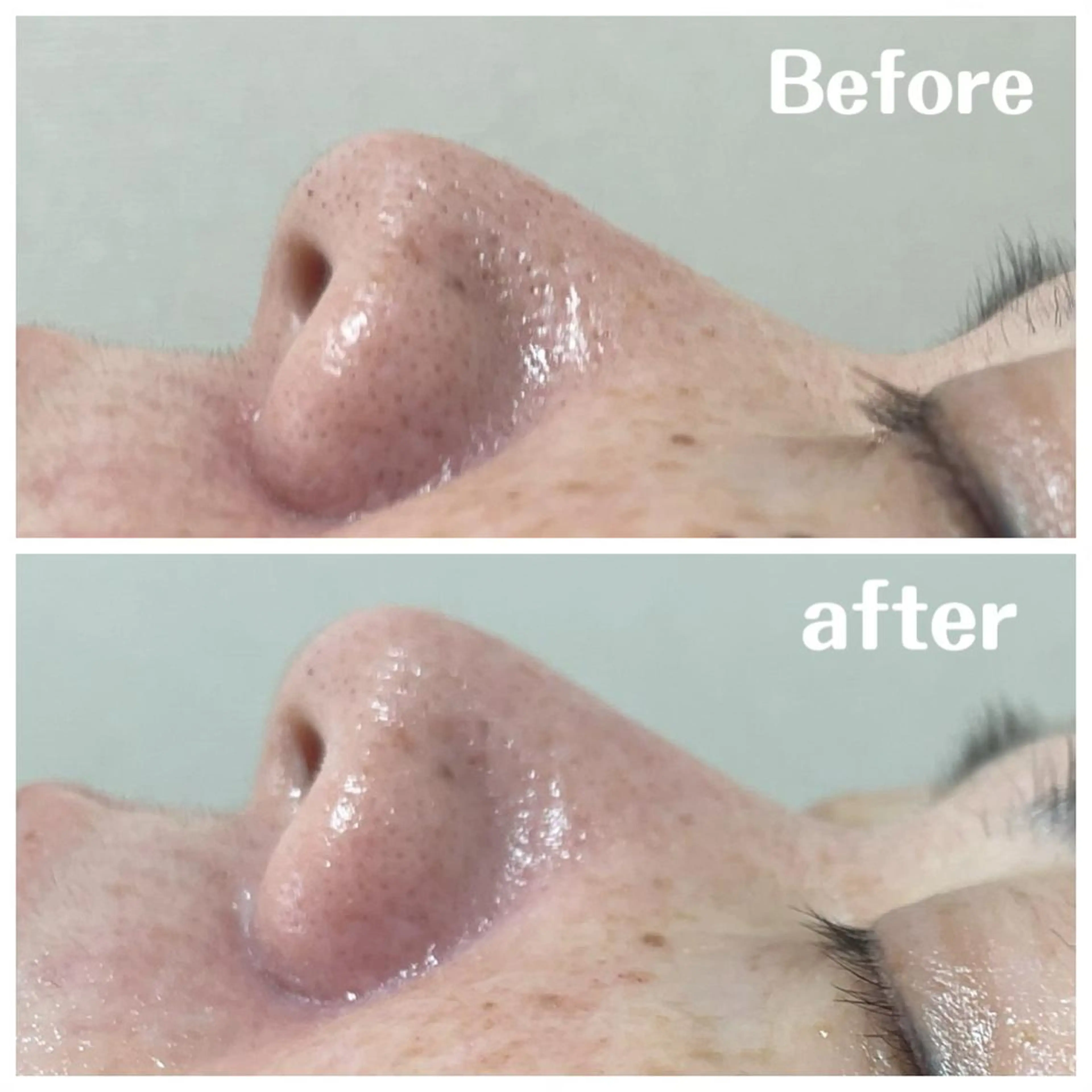 エステ リラク 肌質改善サロン facialmoonのエステ・リラクイメージ