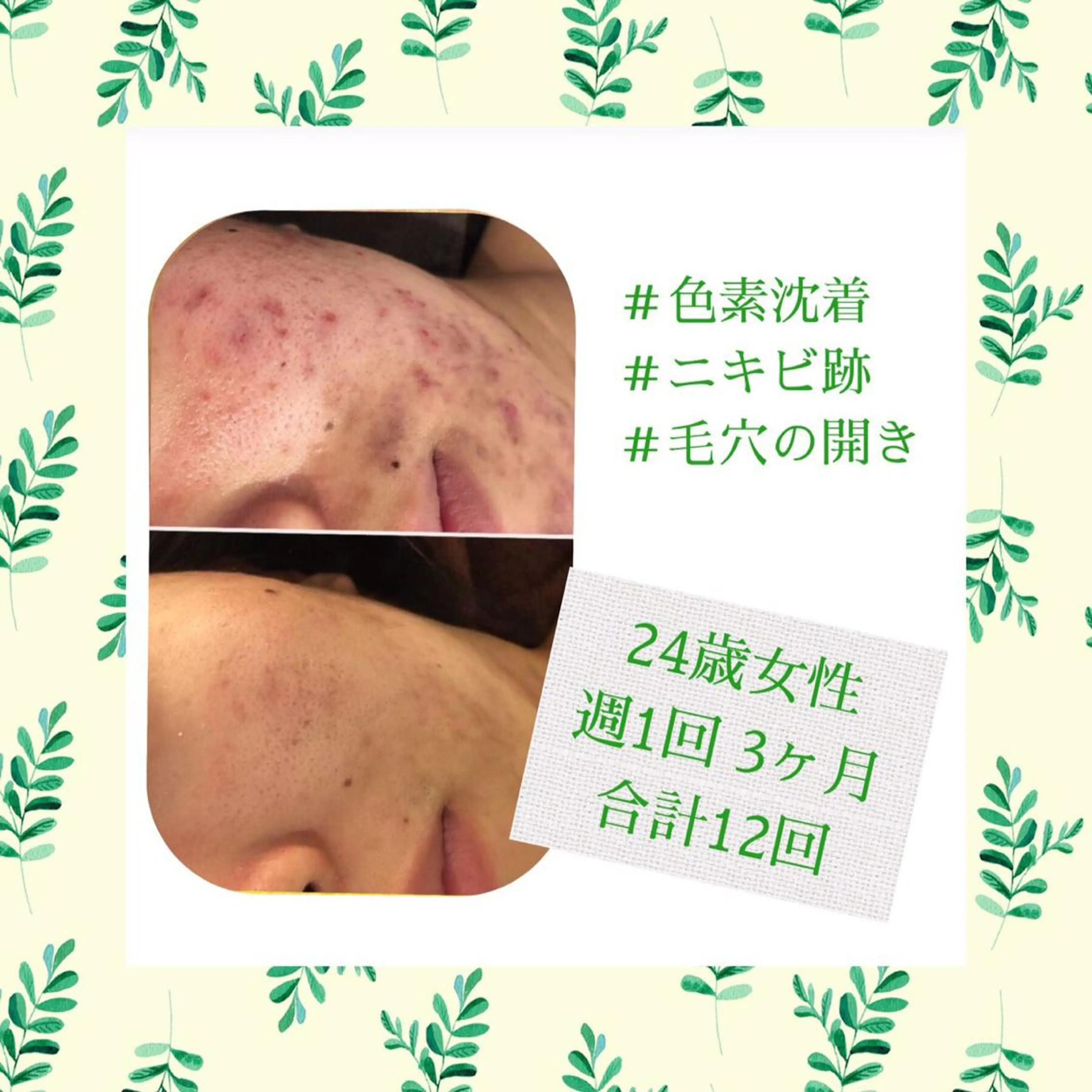 ミディアム カラー パーマ ヘアアレンジ メンズ キッズ ネイル マツエク・マツパ ニキビ・肌質改善専門 ♡人生が変わるサロンのエステ・リラクイメージ