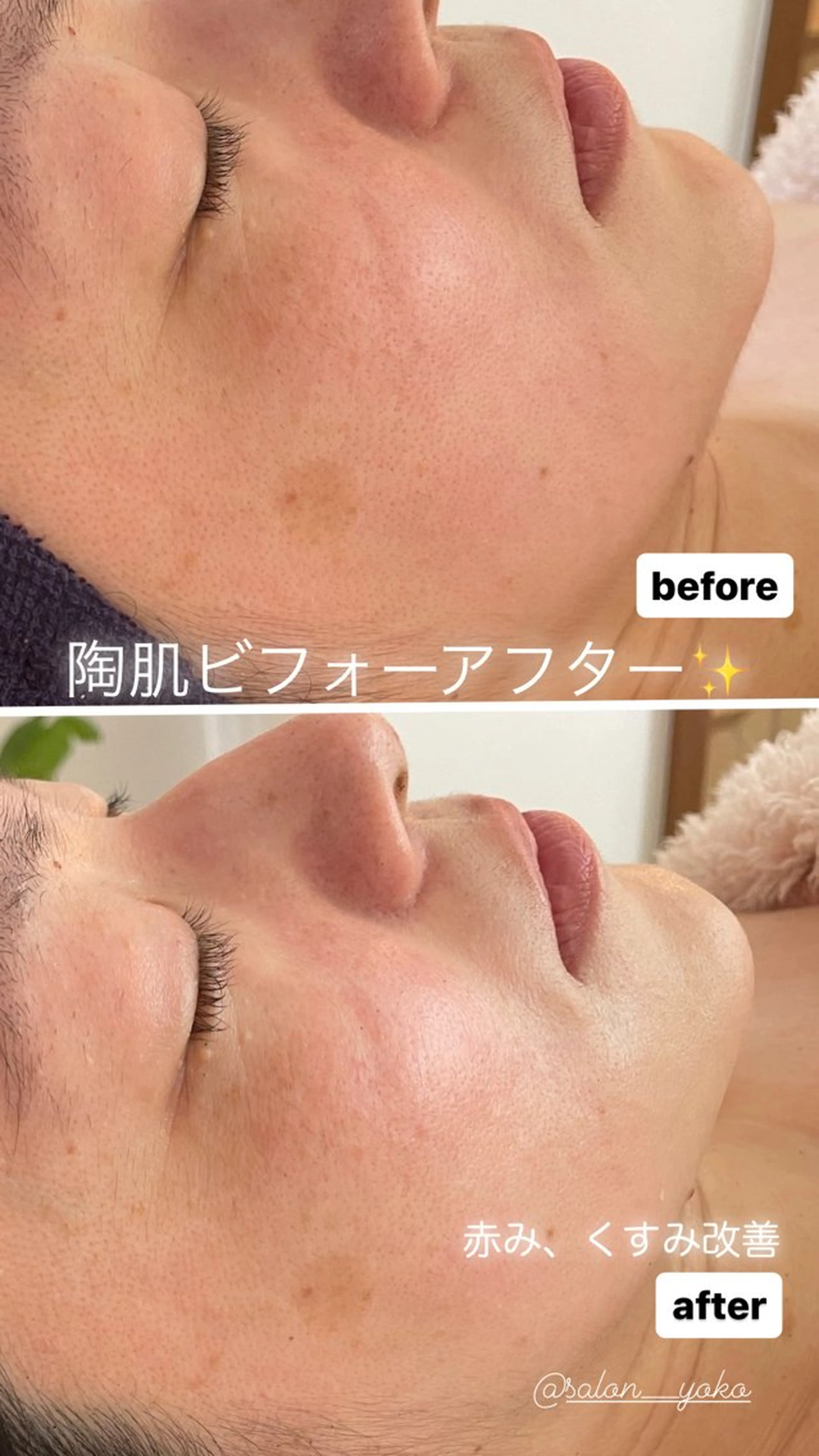 その他 アロマ•ピーリング SalonYokoのその他イメージ