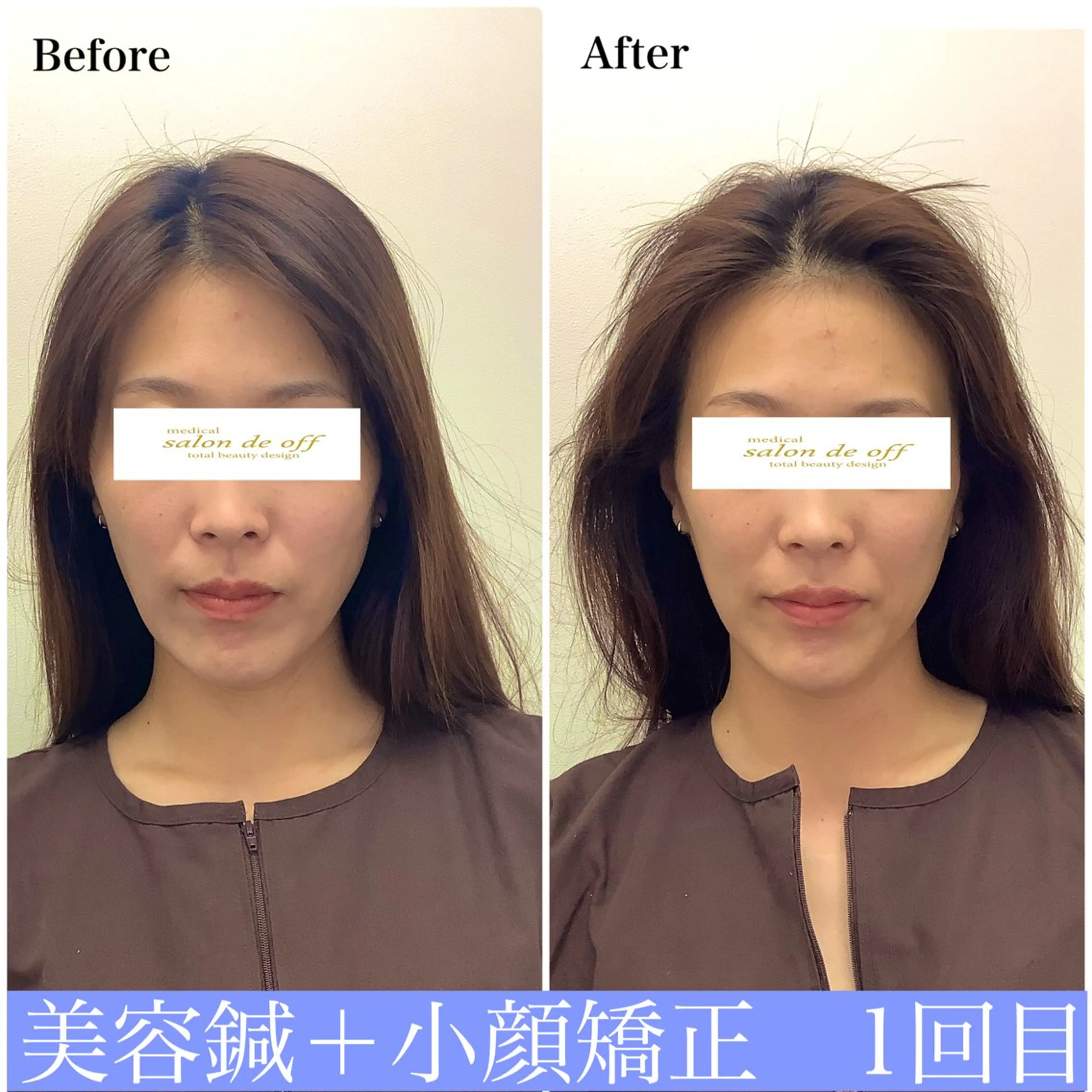 エステ リラク ハリサロンドオフ 美容鍼灸×小顔整体のエステ・リラクイメージ