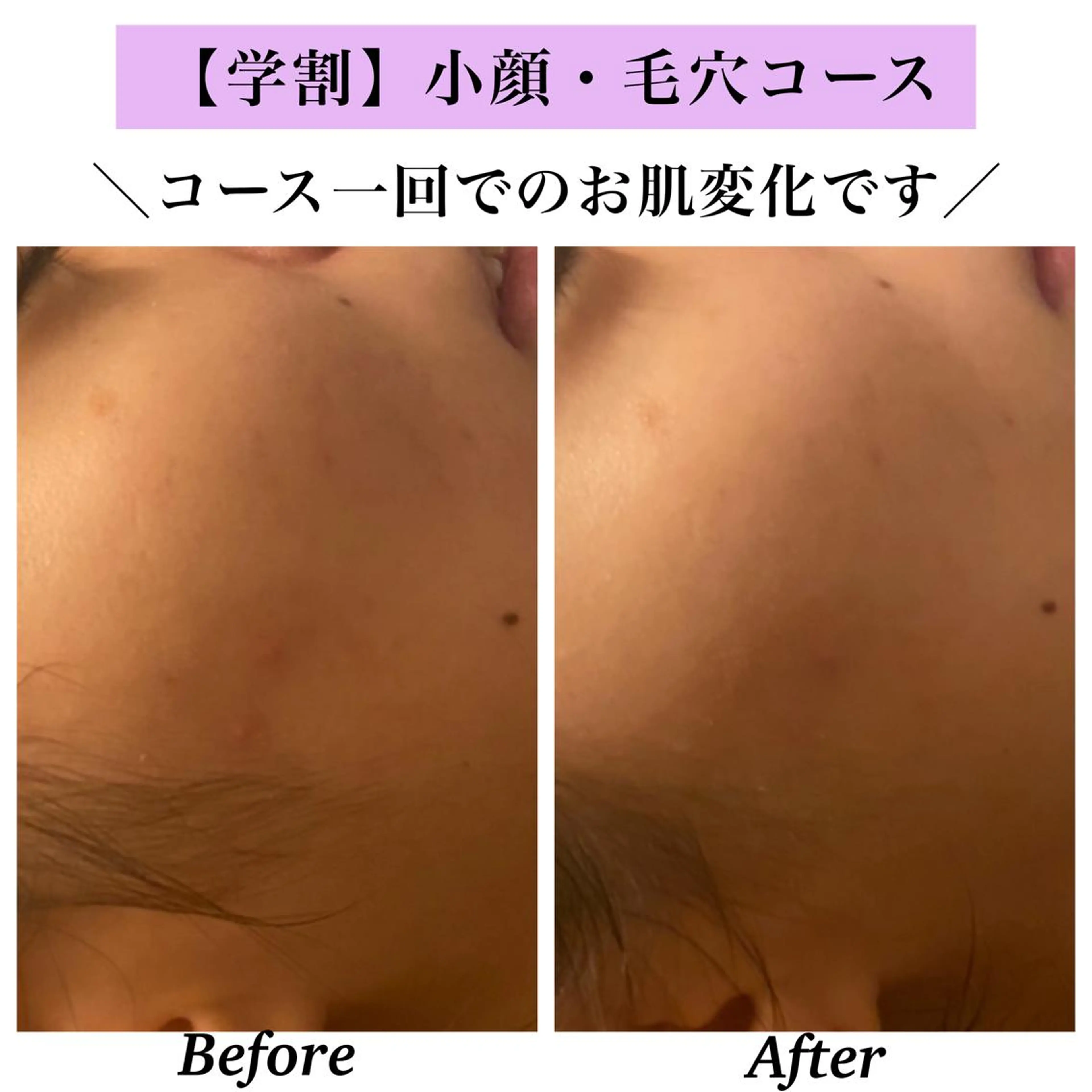 Bellesthe (ベルエステ)のエステ・リラクイメージ