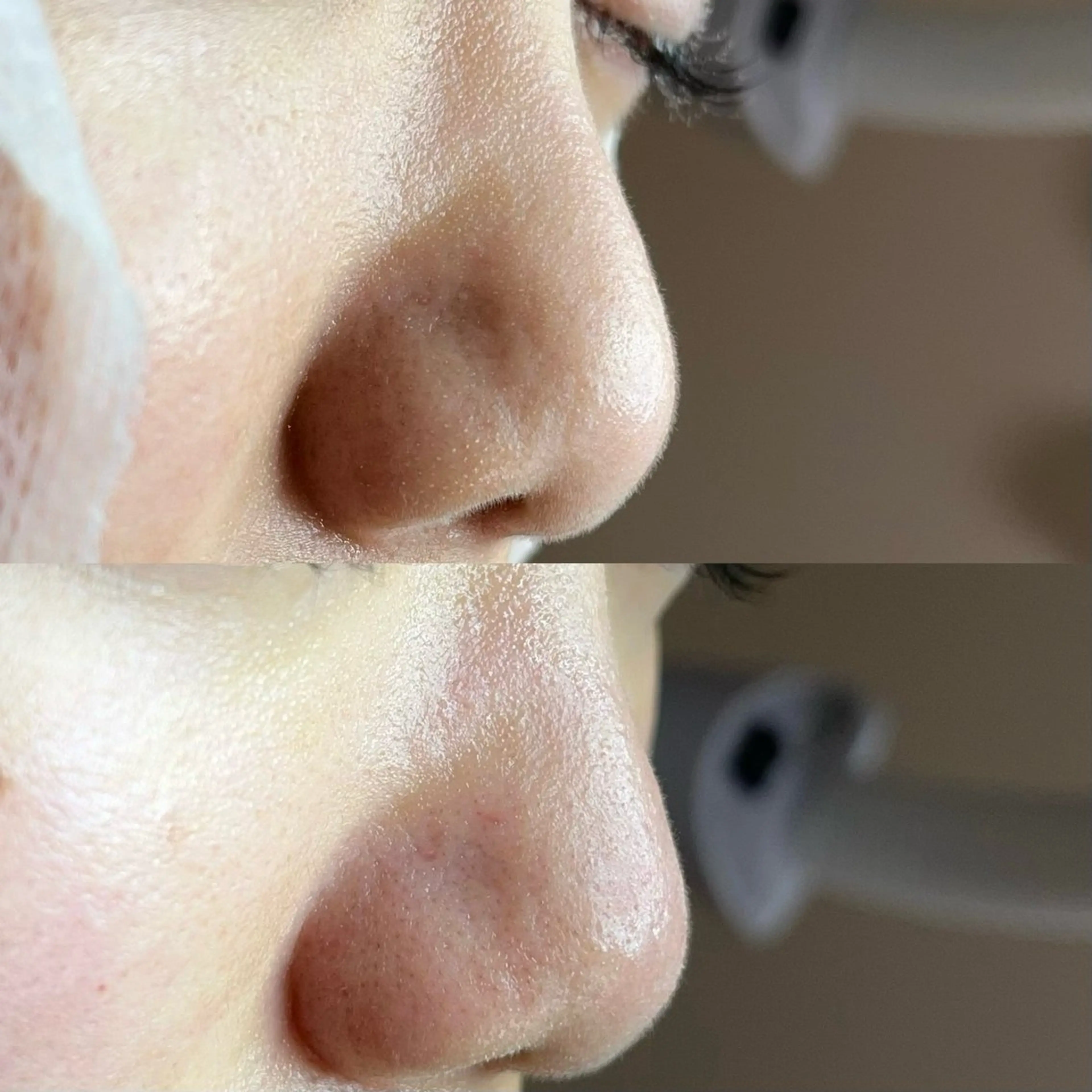 毛穴ケア・ヘッドスパ サロンSHINYのエステ・リラクイメージ