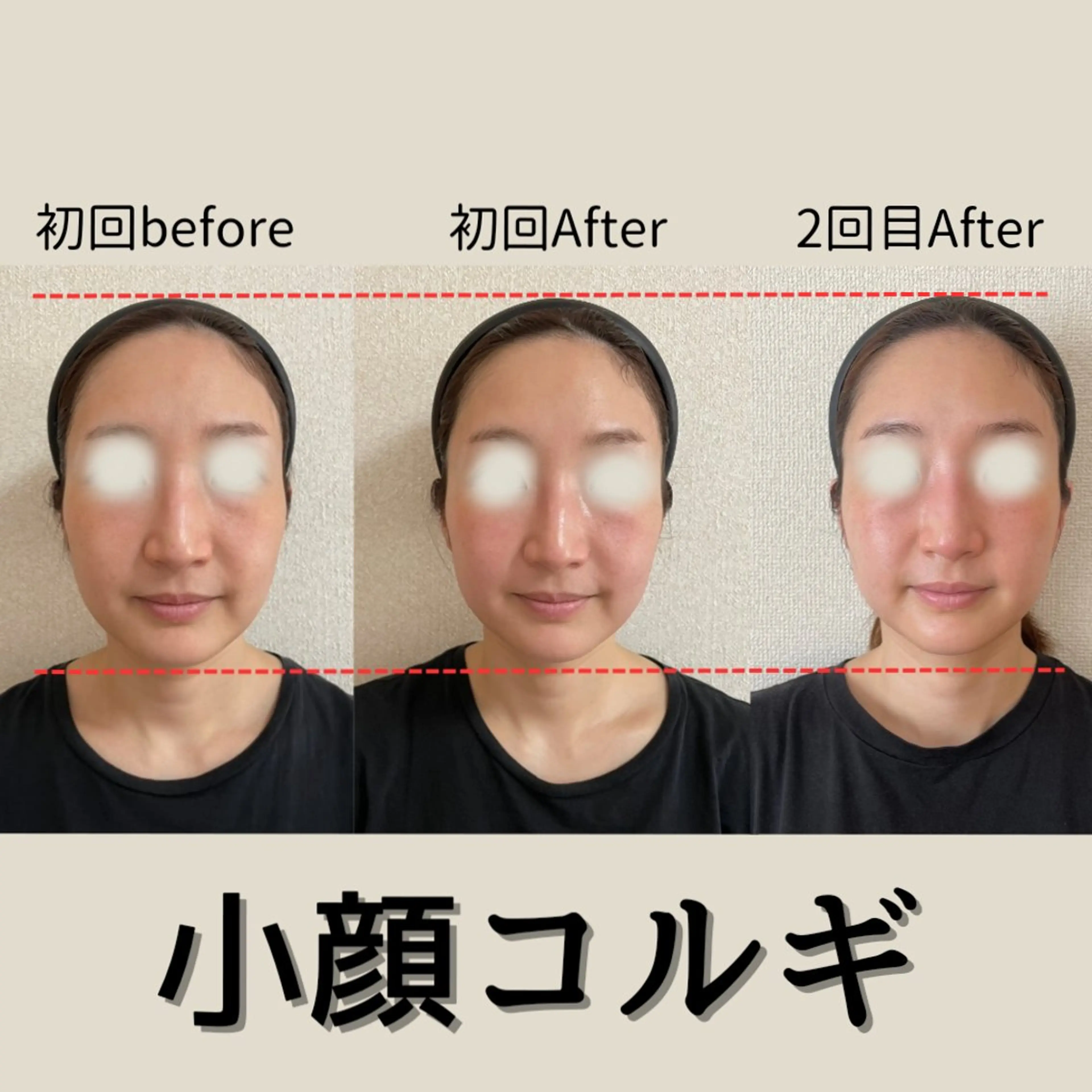 小顔コルギ&肌質改善 の専門店LIBREのエステ・リラクイメージ