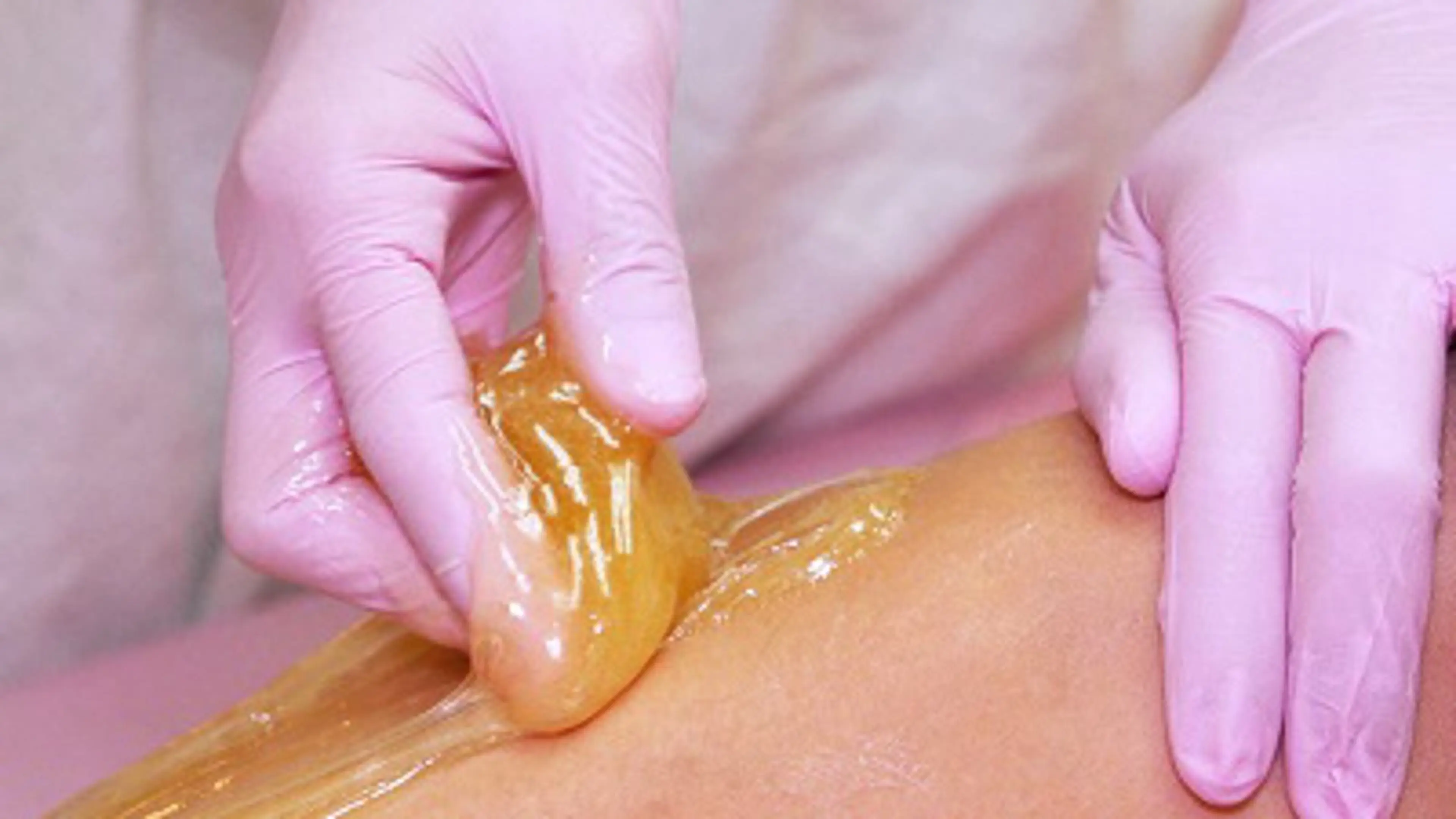 【シュガーリングWAX‪でVIO脱毛】の写真