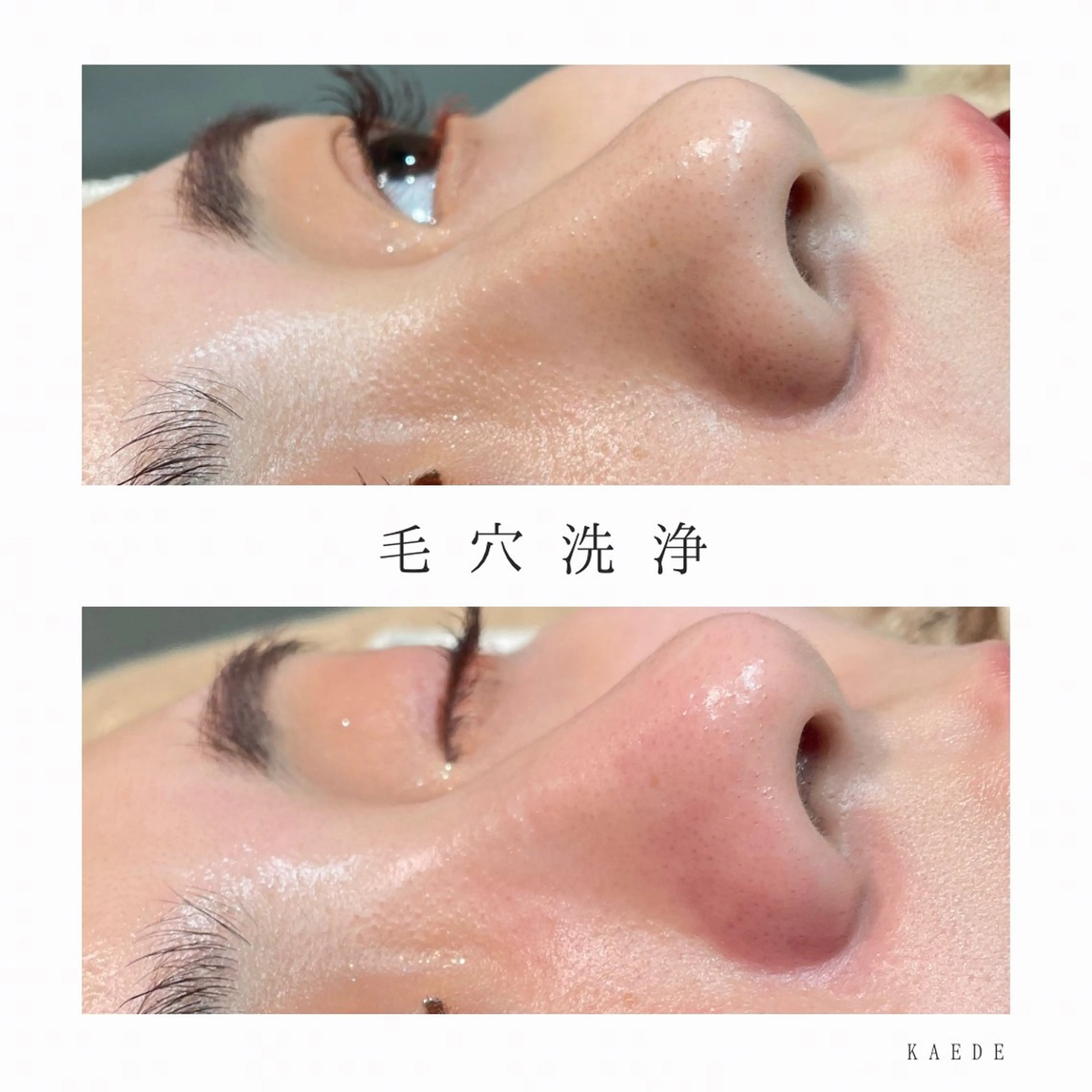 🎀kaede🎀 骨格似合わせ眉毛の眉毛・アイブロウイメージ