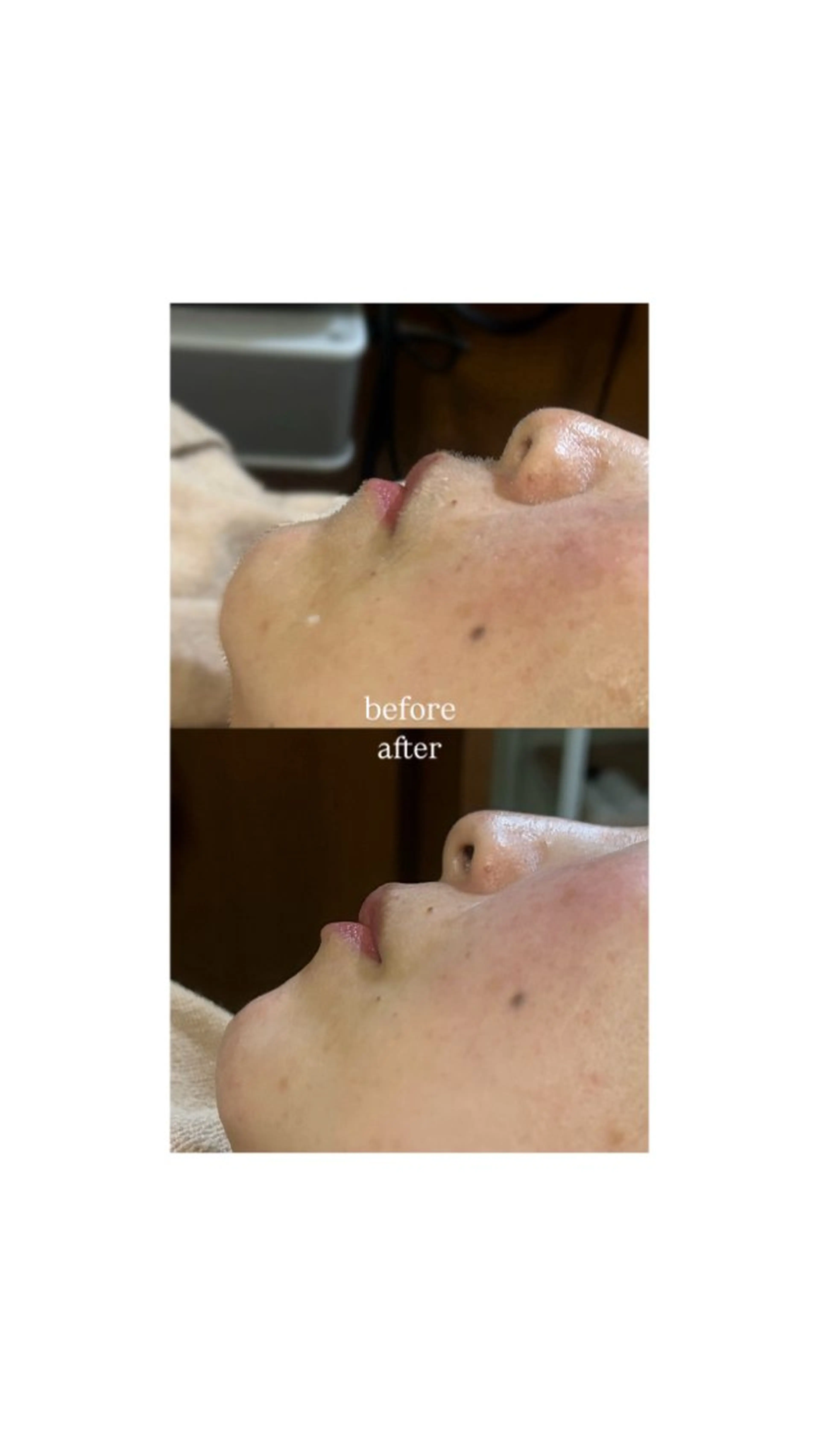 理容室AZ Inadaのエステ・リラクイメージ