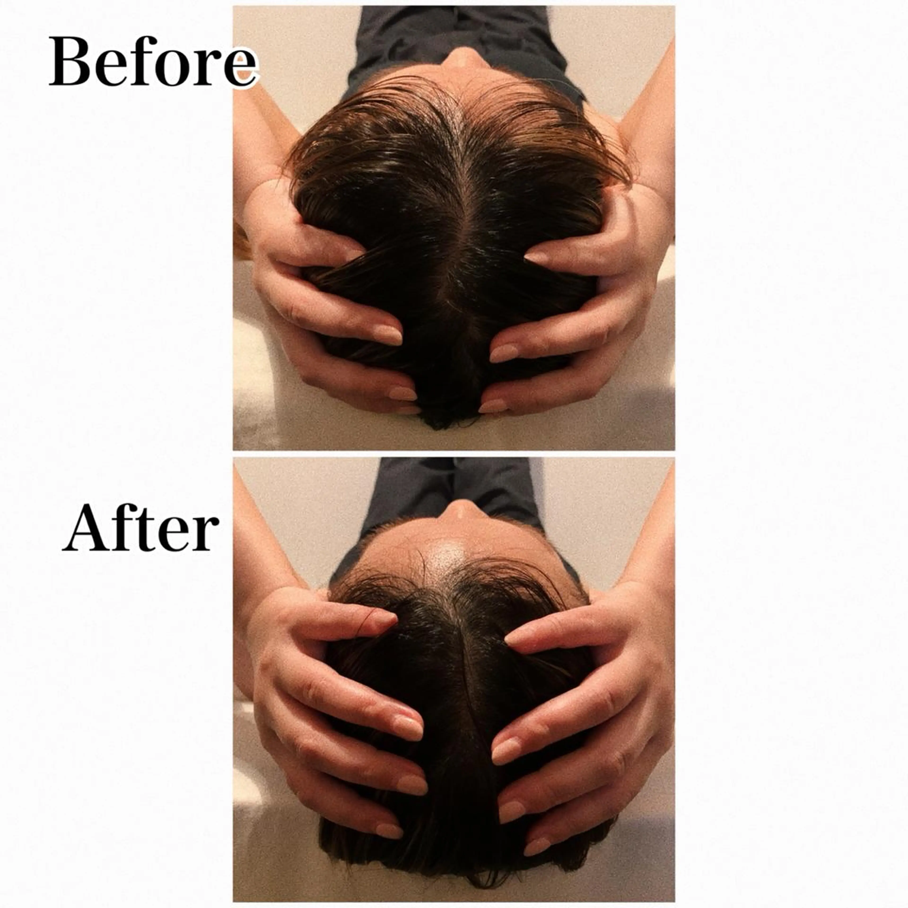 エステ リラク ielu〜毛穴ケア ハーブピーリングのエステ・リラクイメージ