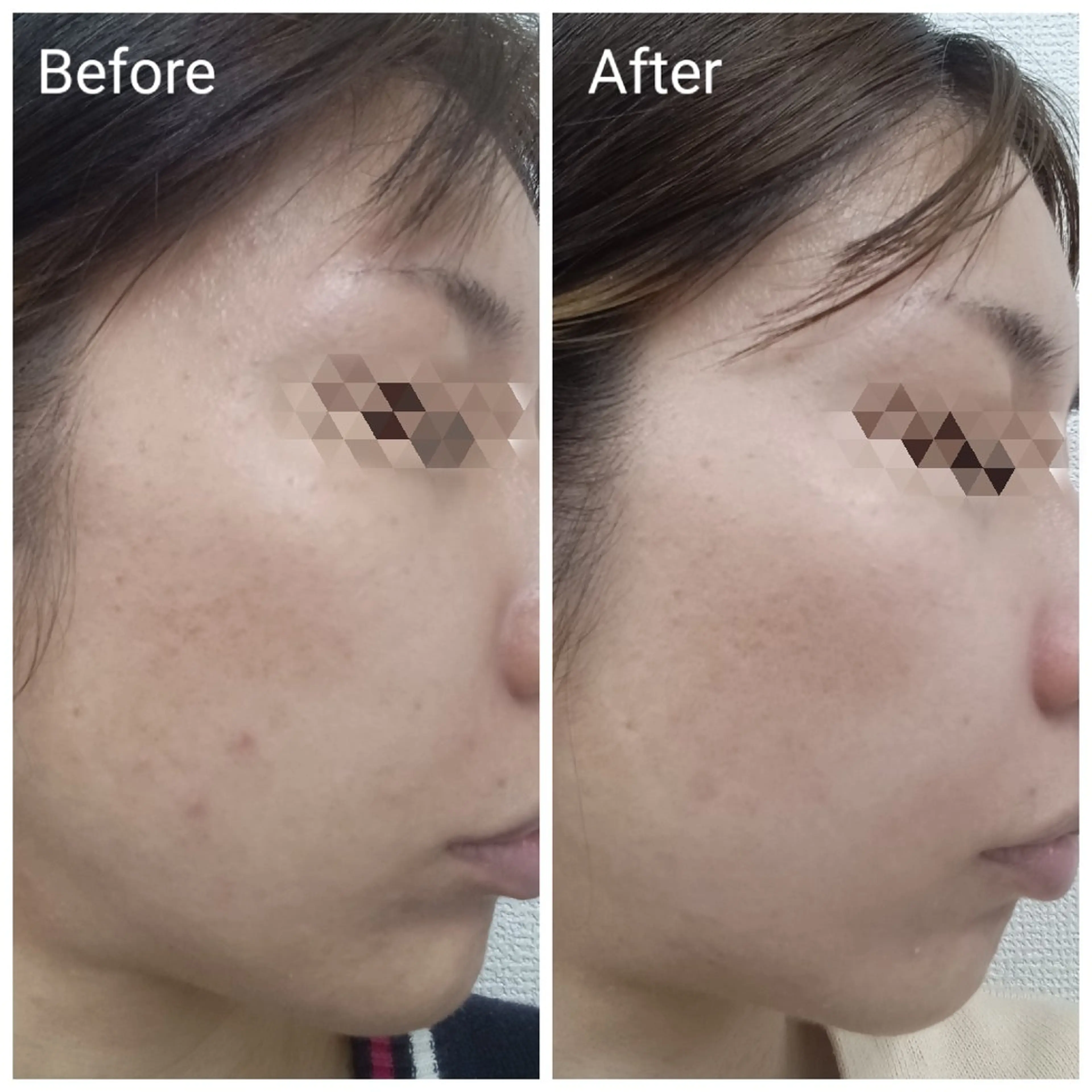 肌質改善Beauty salon Renのエステ・リラクイメージ