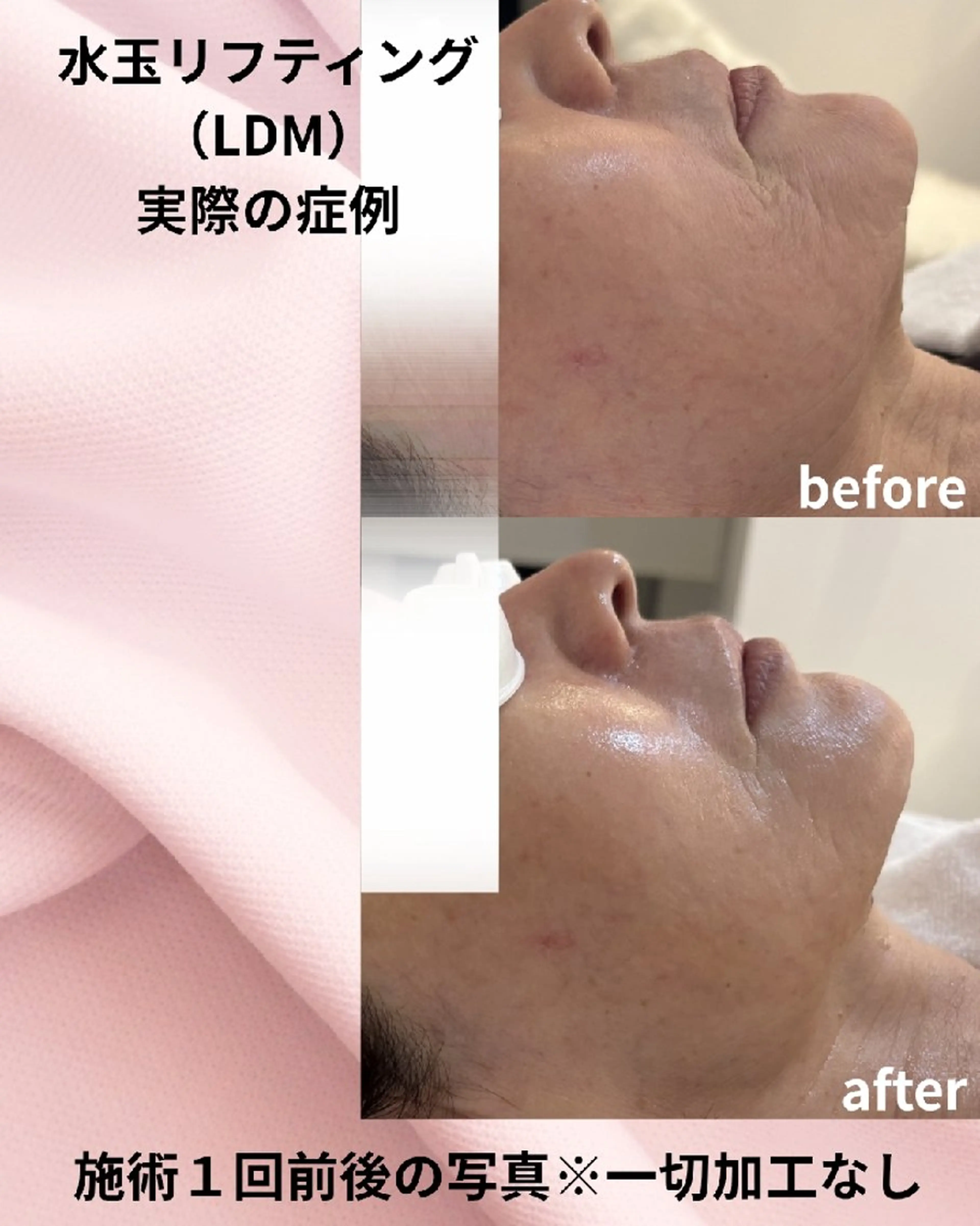 エステ Maum SkinSalonのエステ・リラクイメージ