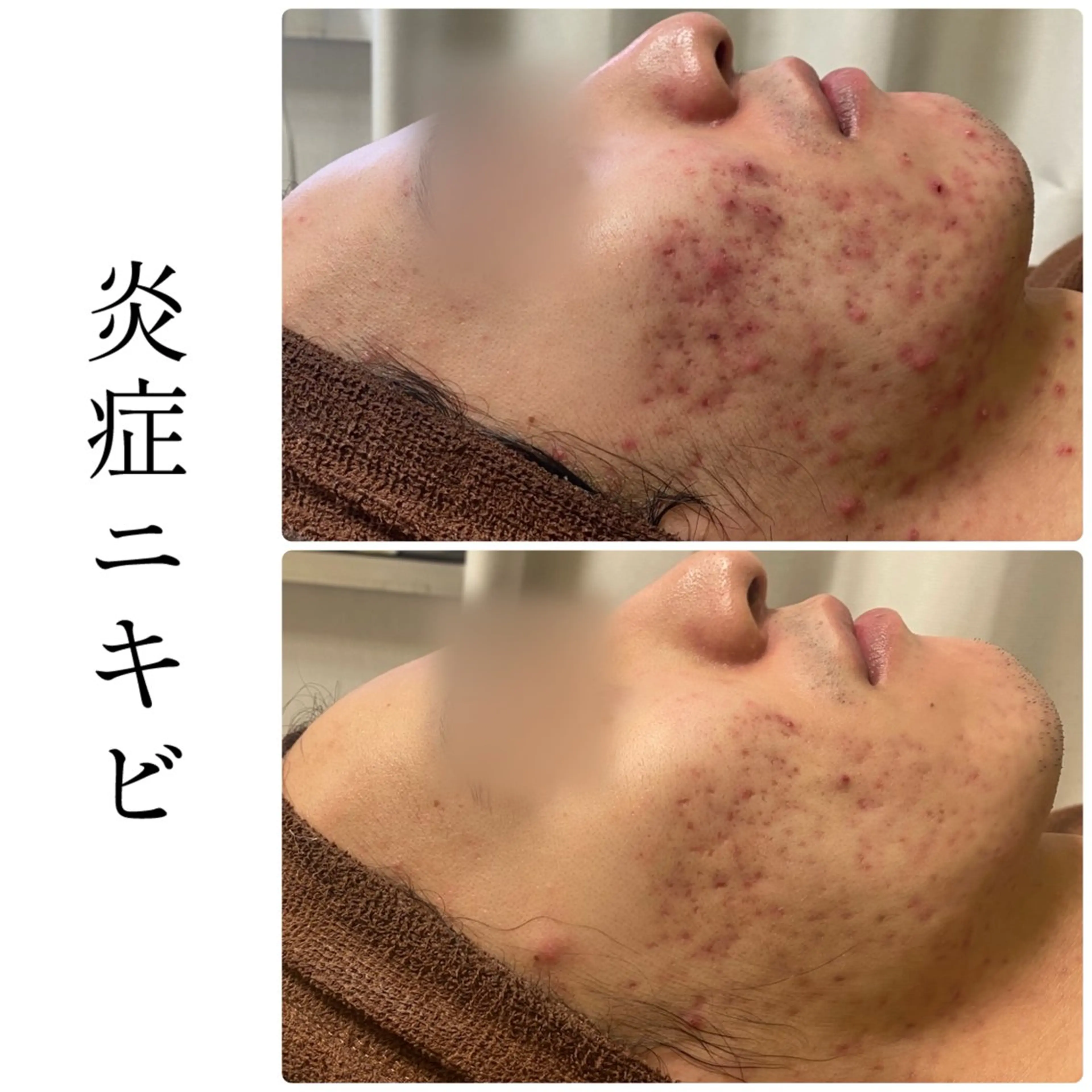 エステ ハーブピーリング専門 BIOEL横浜のエステ・リラクイメージ