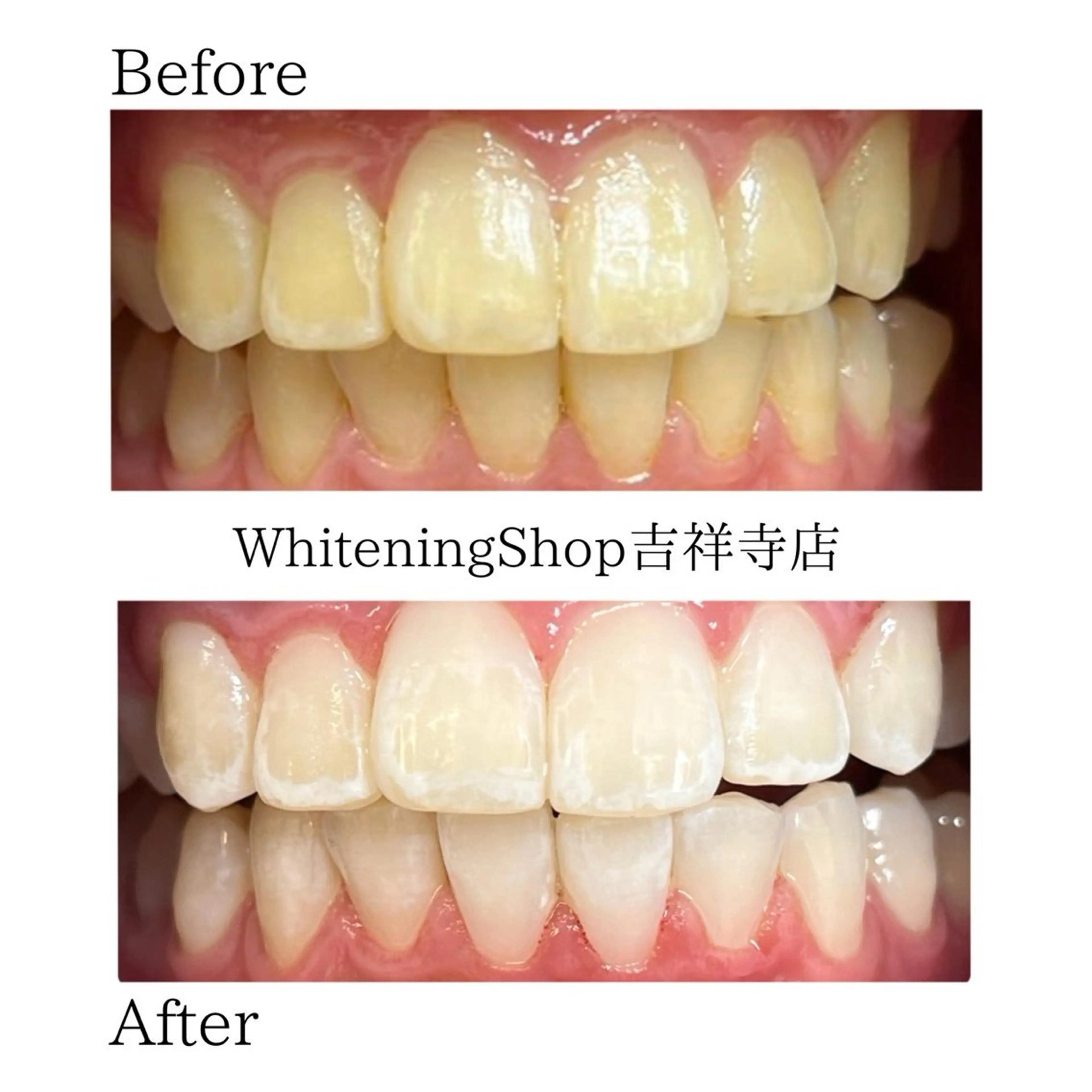 エステ リラク ホワイトニング ショップ吉祥寺店のエステ・リラクイメージ