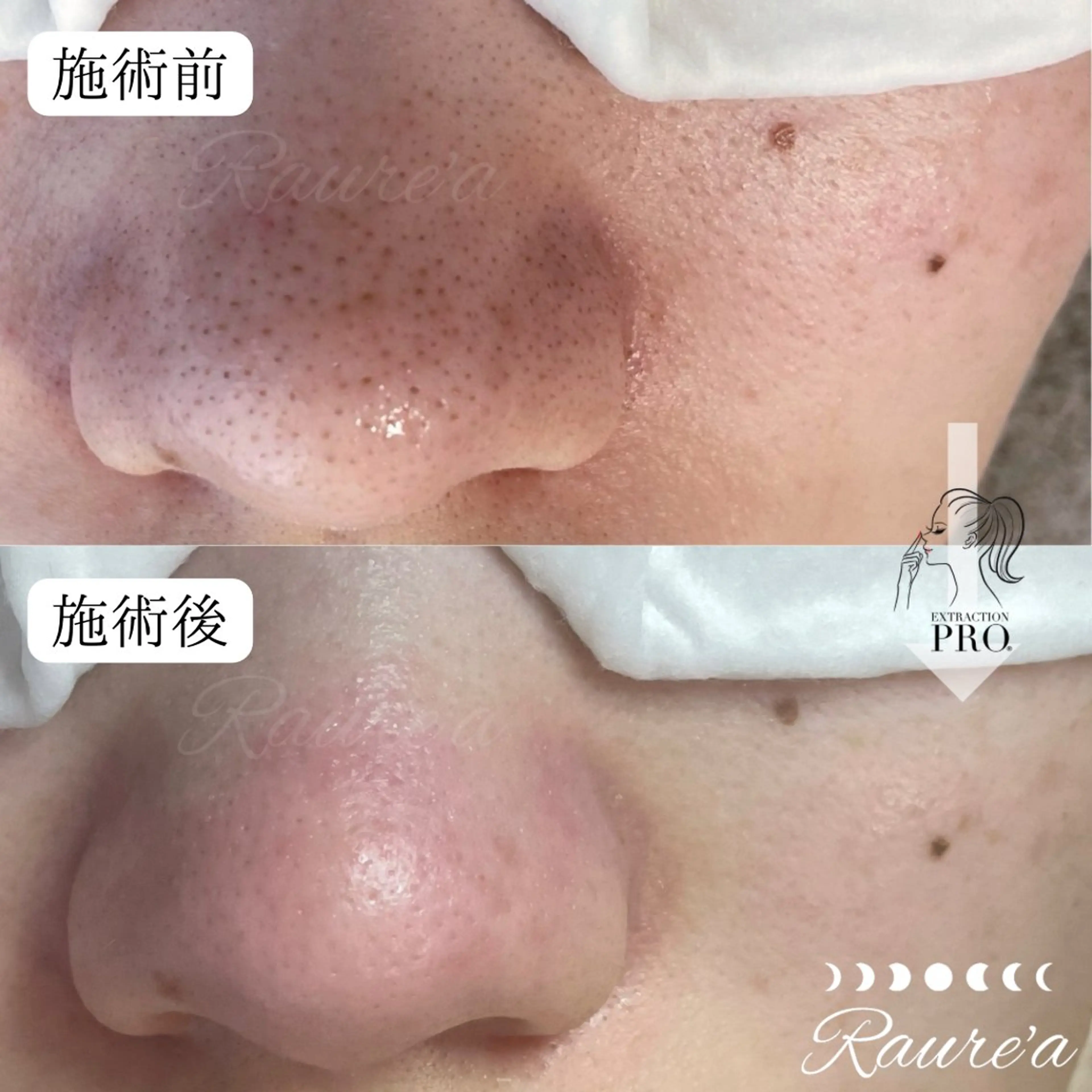 Raure'a Yurikoのマツエク・マツパデザイン