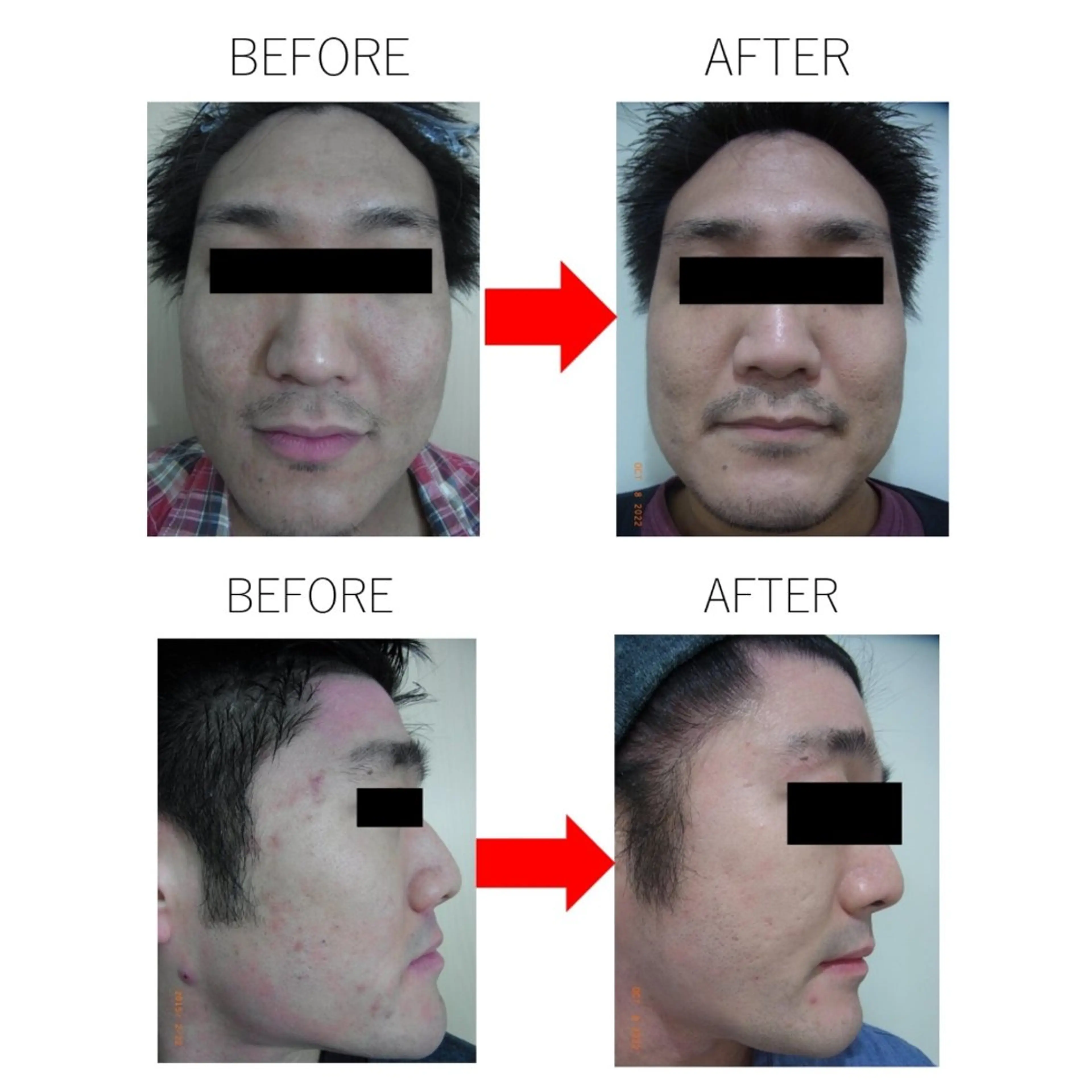 【男性限定】パーソナライズケアの写真