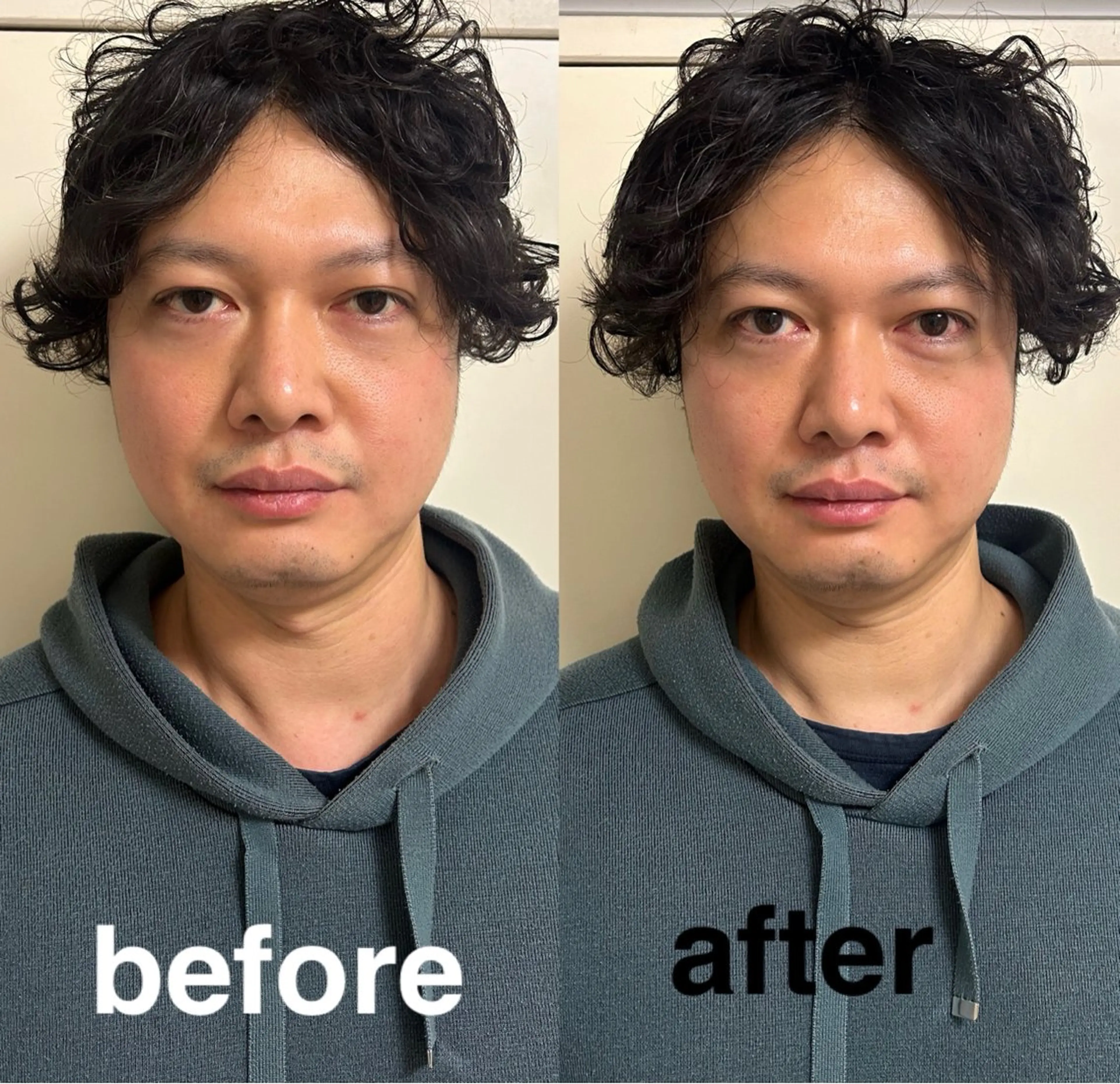 美容鍼灸サロン mahoroba院長のエステ・リラクイメージ