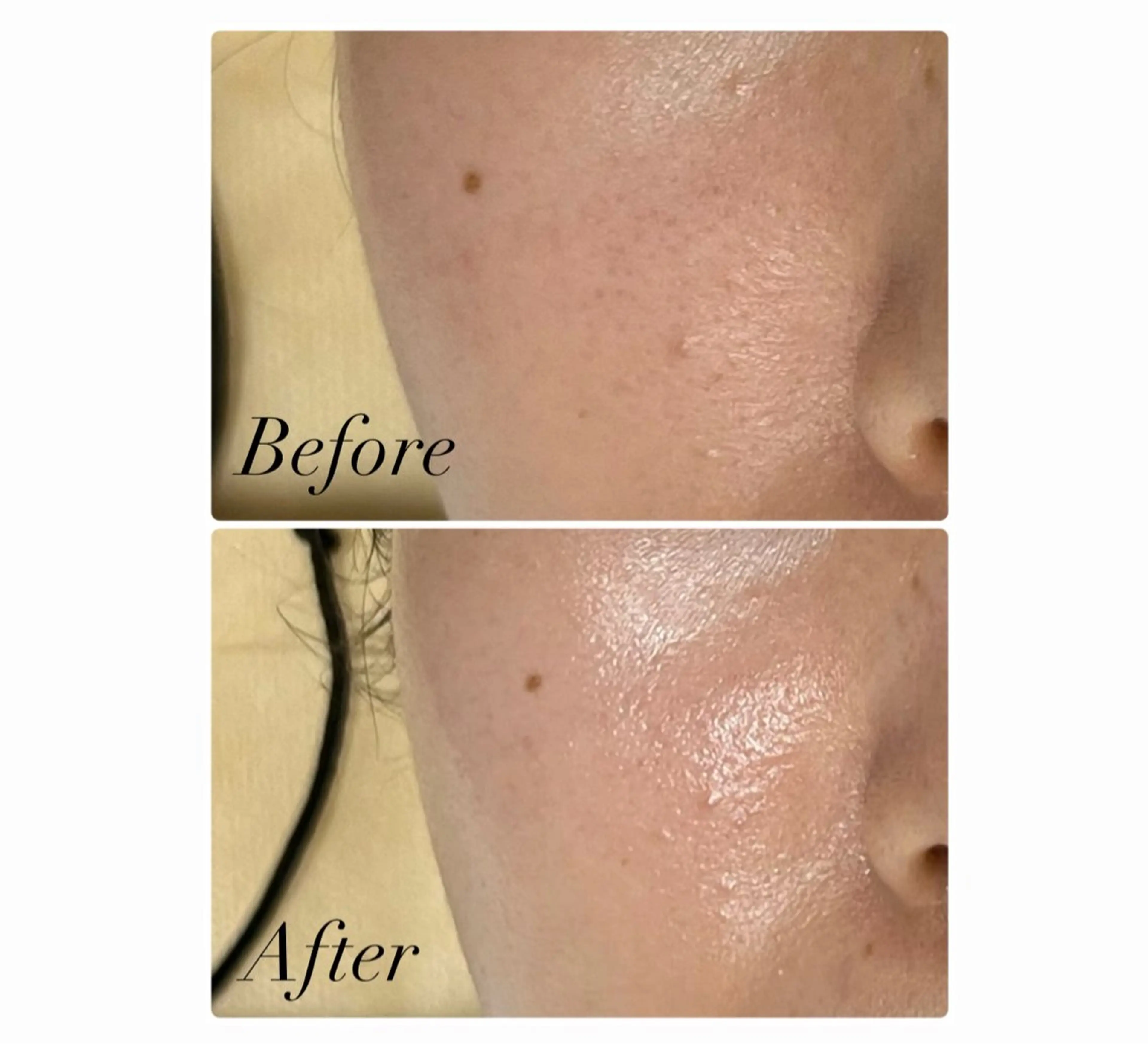 エステ ROR Akariのエステ・リラクイメージ