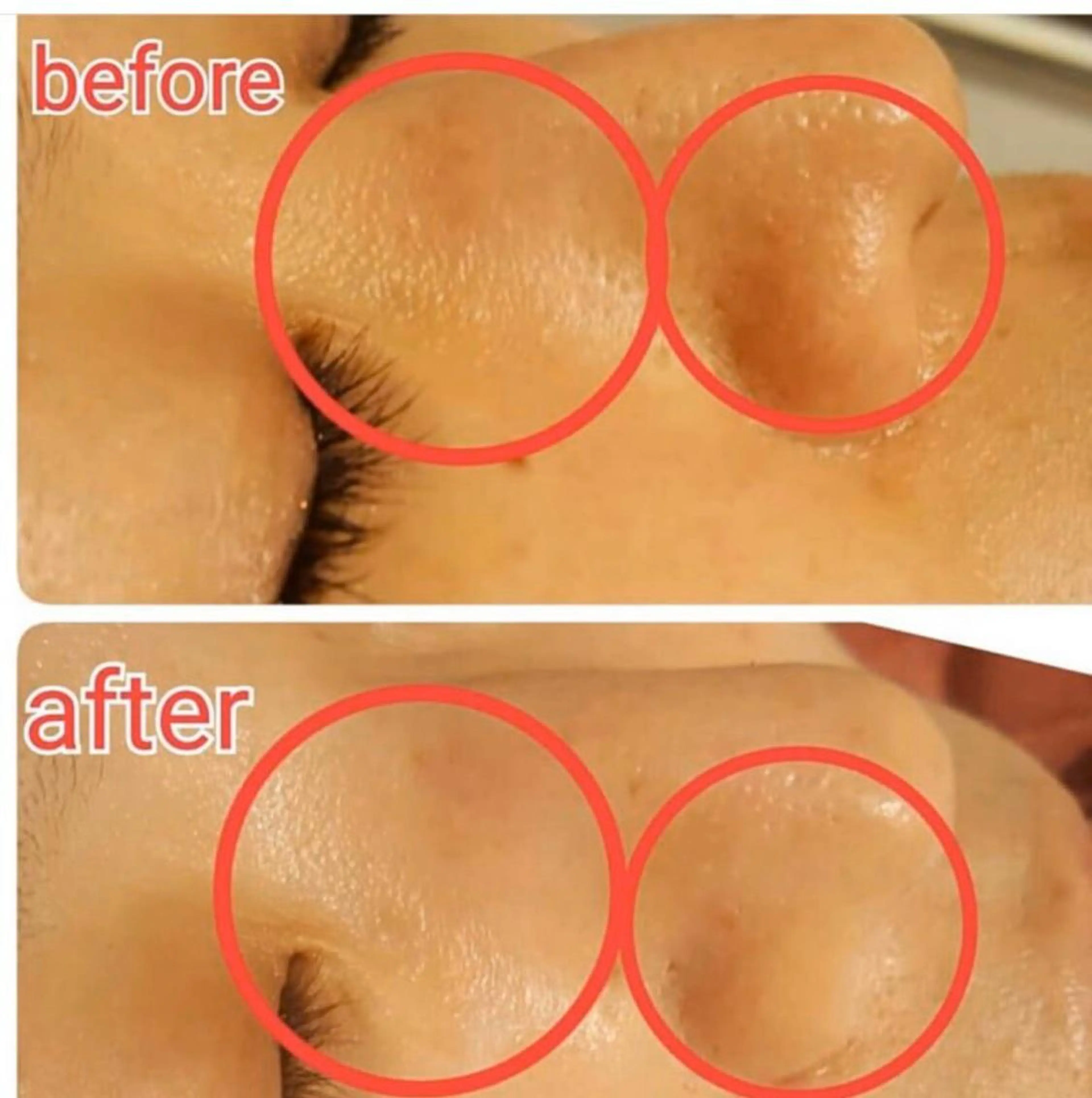 ☆初回限定☆🌿剥けないハーブピーリング🌿角質ローション付!陶肌フェイシャル90分 通常26,500円→5200円!の写真