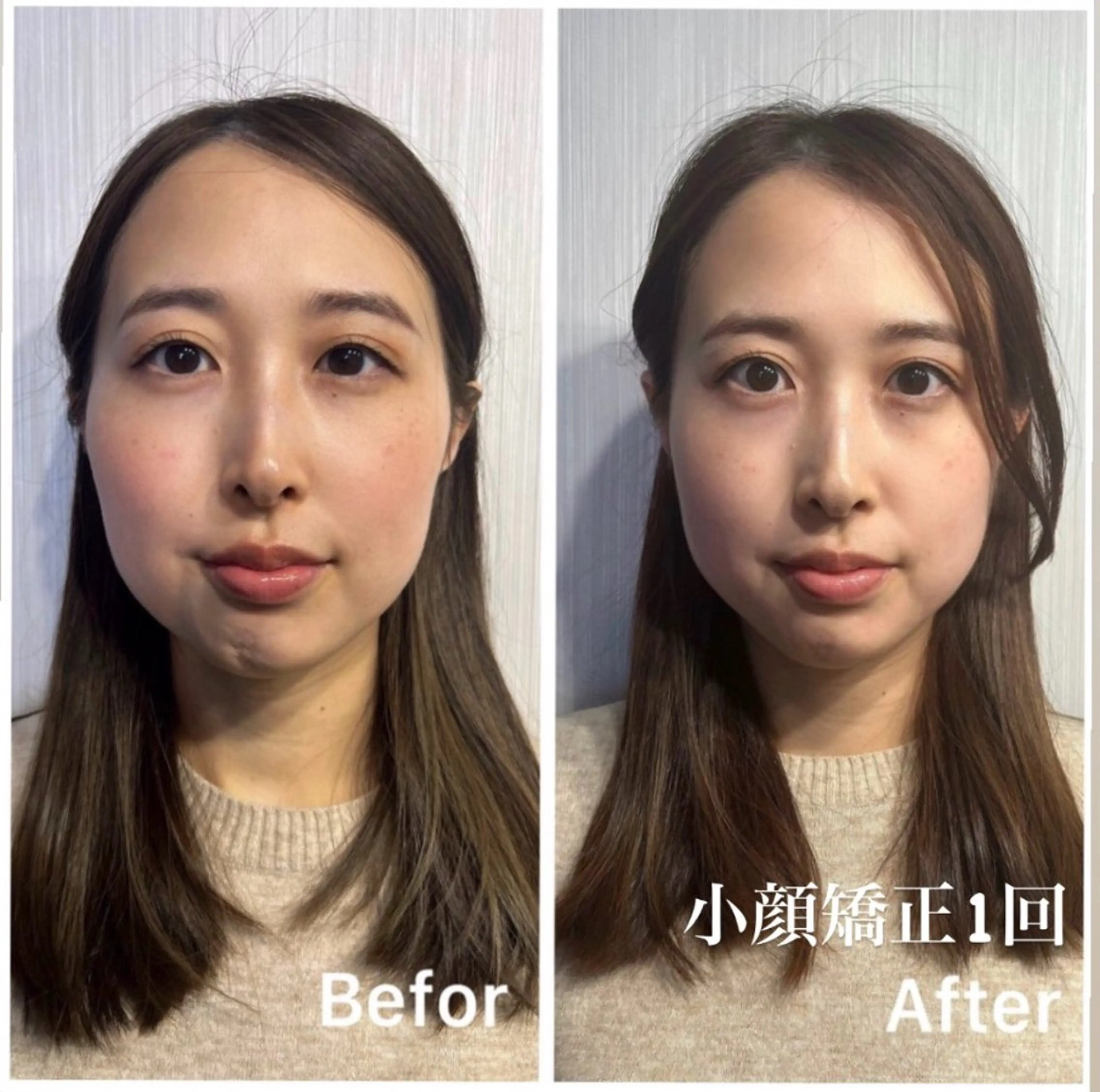 《何度も使える》左右差/歪みに◎独自メソッドの小顔矯正¥15000の写真