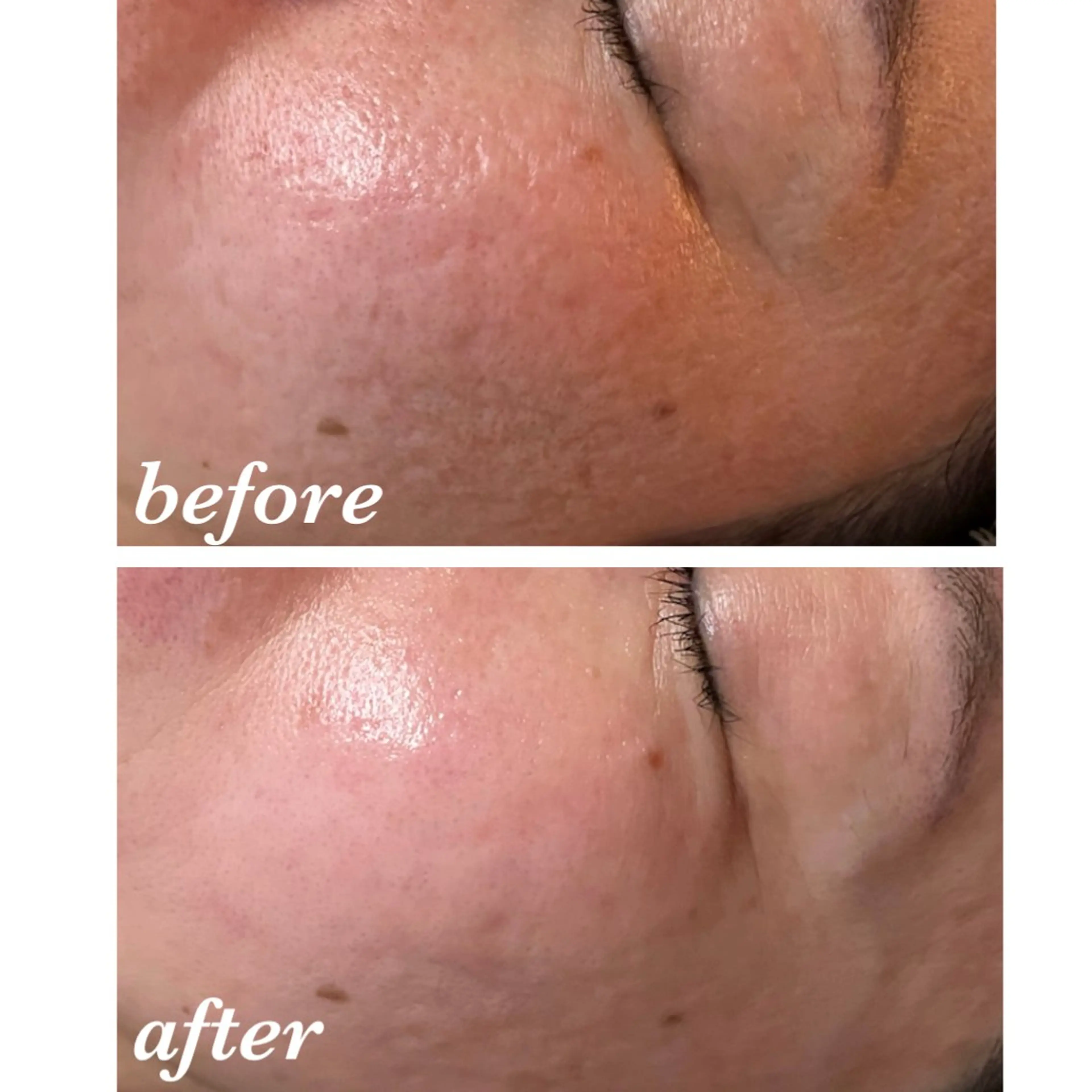 エステ リラク 結果重視｜毛穴エステ ｜友綱理恵のエステ・リラクイメージ