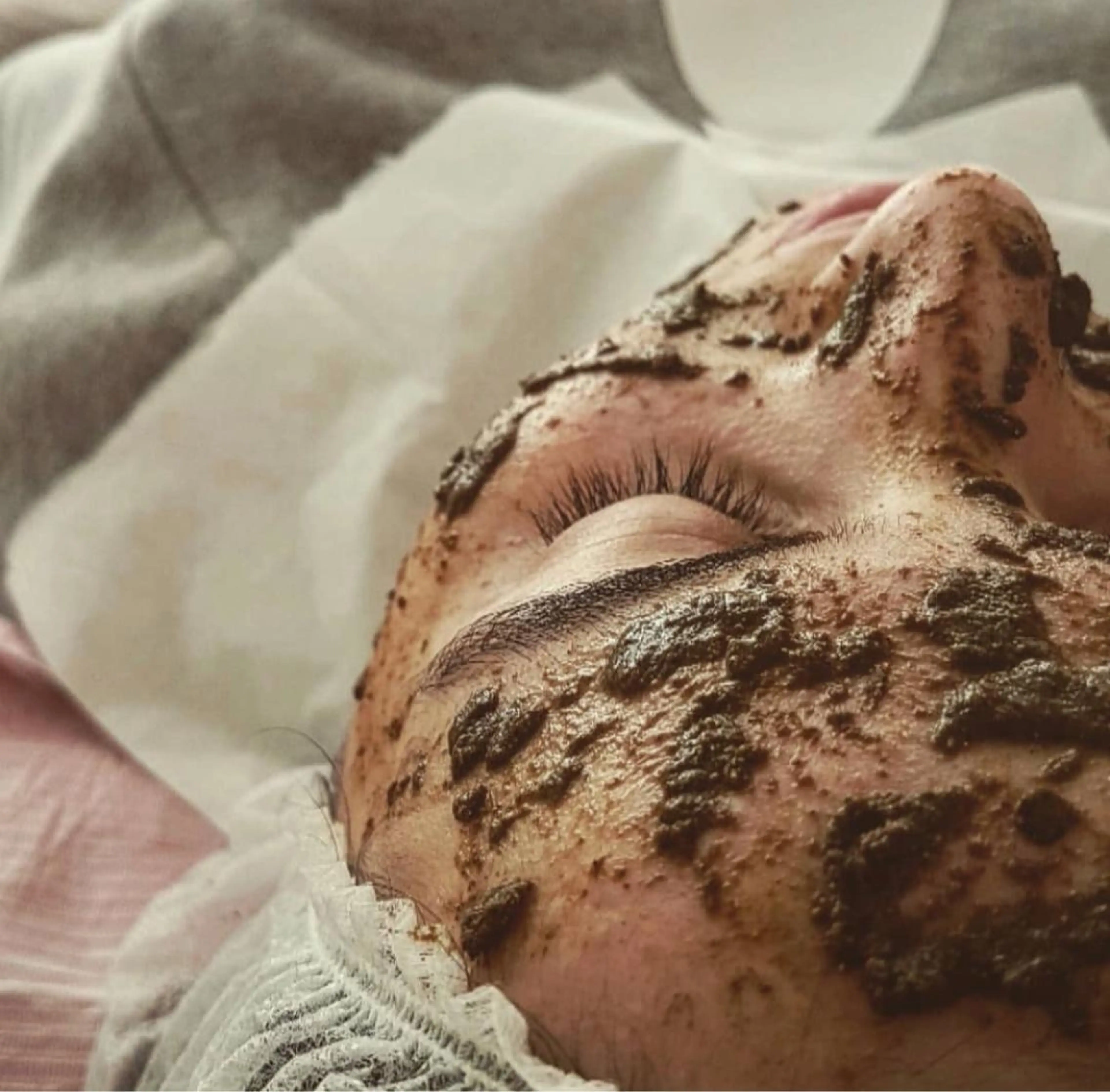 人気NO.3💎【極上美肌／特許ハーブピーリング🌿】発光美肌Glass skin× 敏感肌OK100%2.5高濃度美白の写真