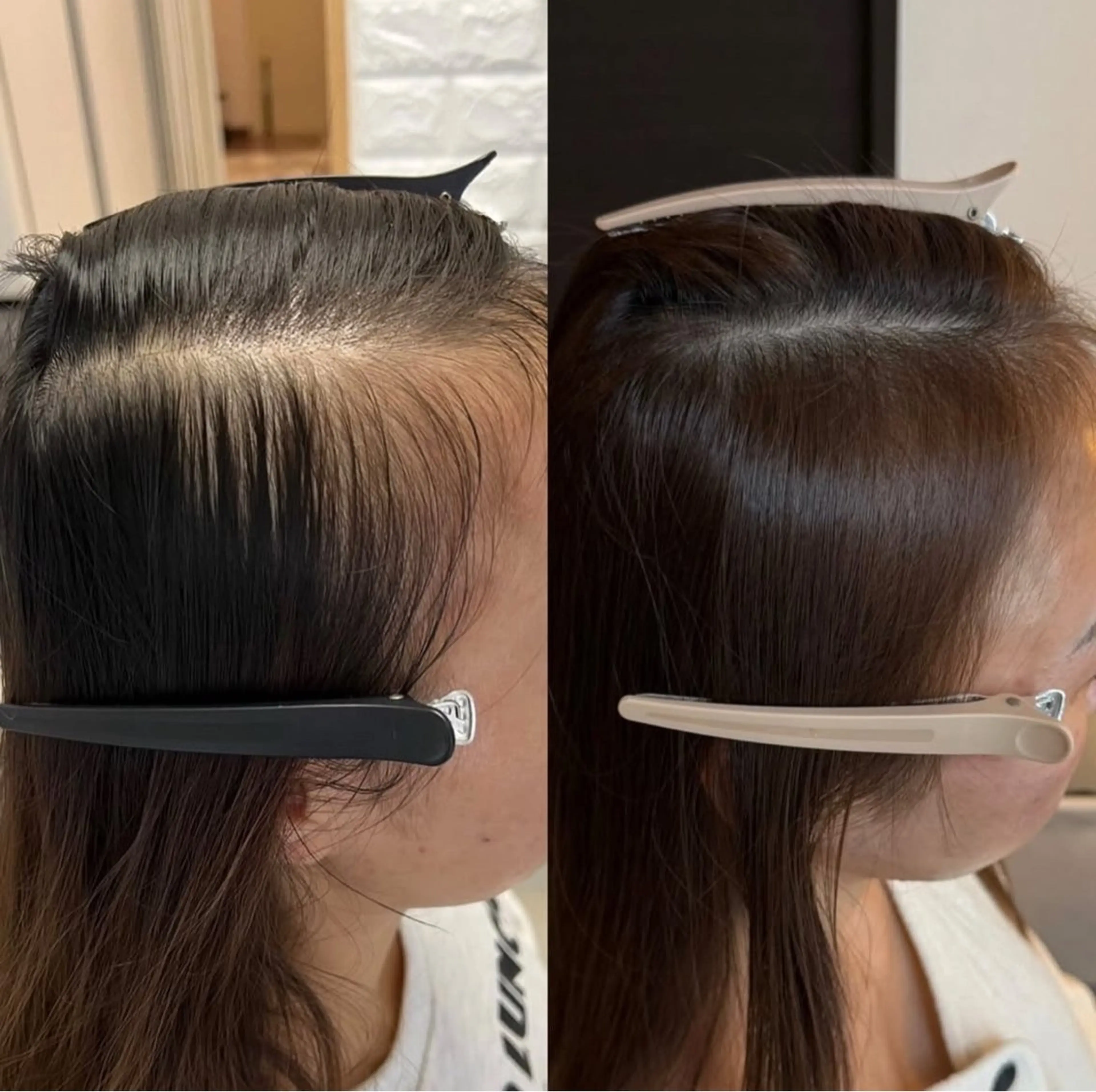 LOUISE. ／肌質・頭皮のエステ・リラクイメージ