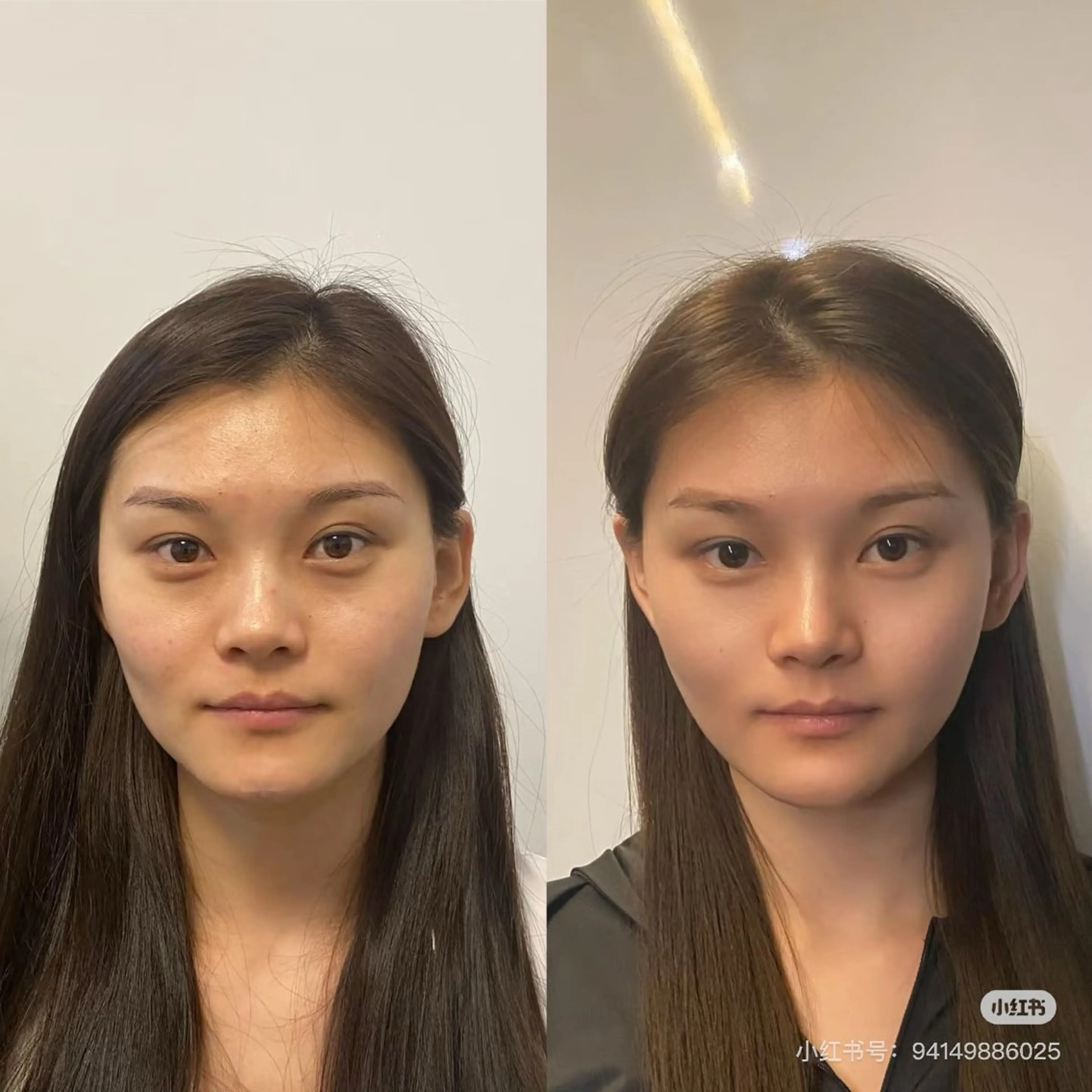 マツエク・マツパ エステ aliaハーブ水光店 エステティシャン募集のエステ・リラクイメージ